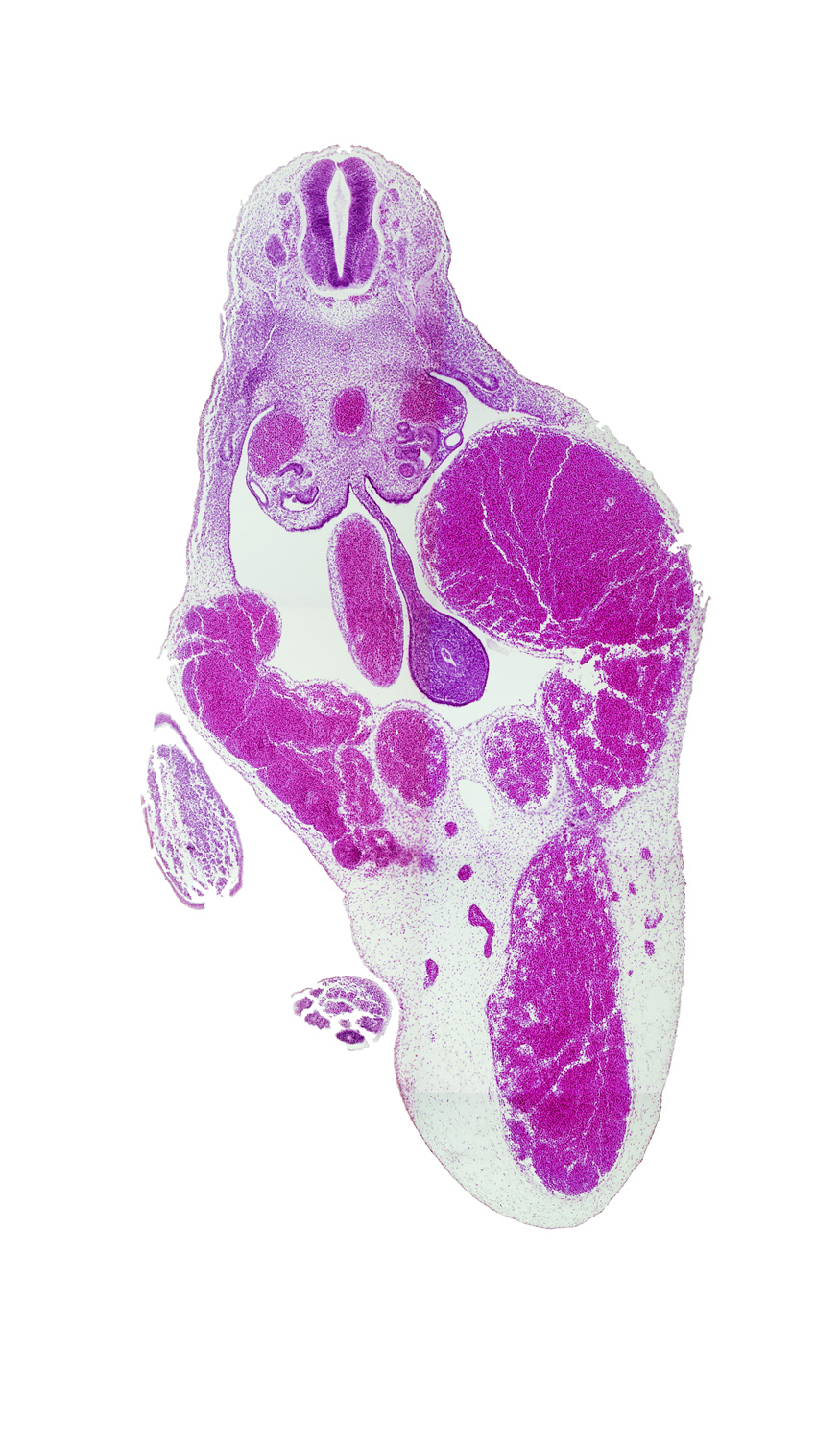 T-8 / T-9 interganglion region, amnion, aorta, caecal swelling, caudal eminence, dorsal mesentery, left umbilical vein, lower limb (distal part), mesonephric duct, postcardinal vein, superior mesenteric artery, surface ectoderm, umbilical cord, umbilical vein