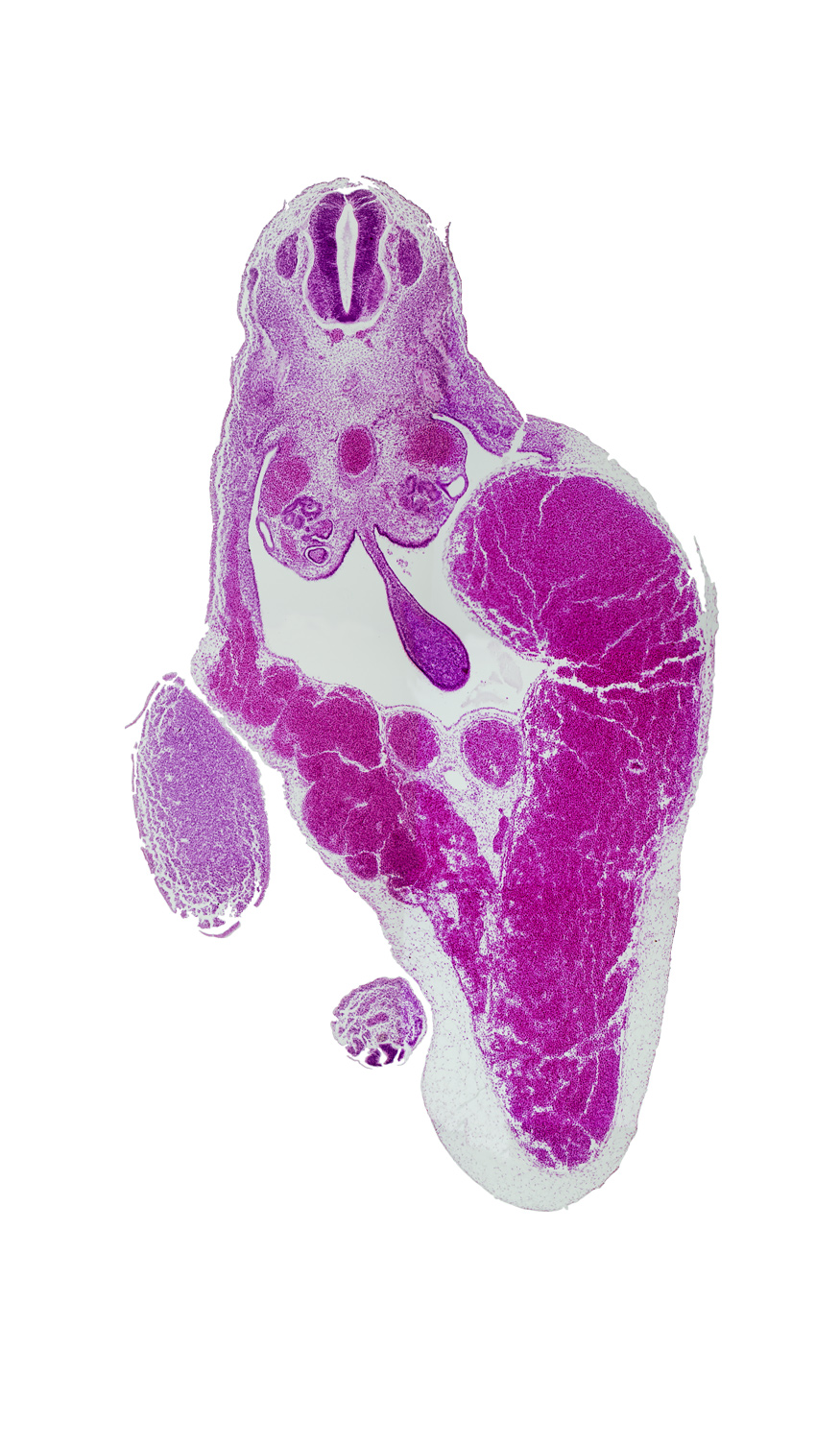 T-9 spinal ganglion, aorta, caudal eminence, common umbilical vein, dermatomyotome, dorsal mesentery, gonadal ridge, junction of umbilical veins, left umbilical vein (congested), mesonephric duct, midgut, peritoneal cavity, rib primordium, right umbilical vein, umbilical cord