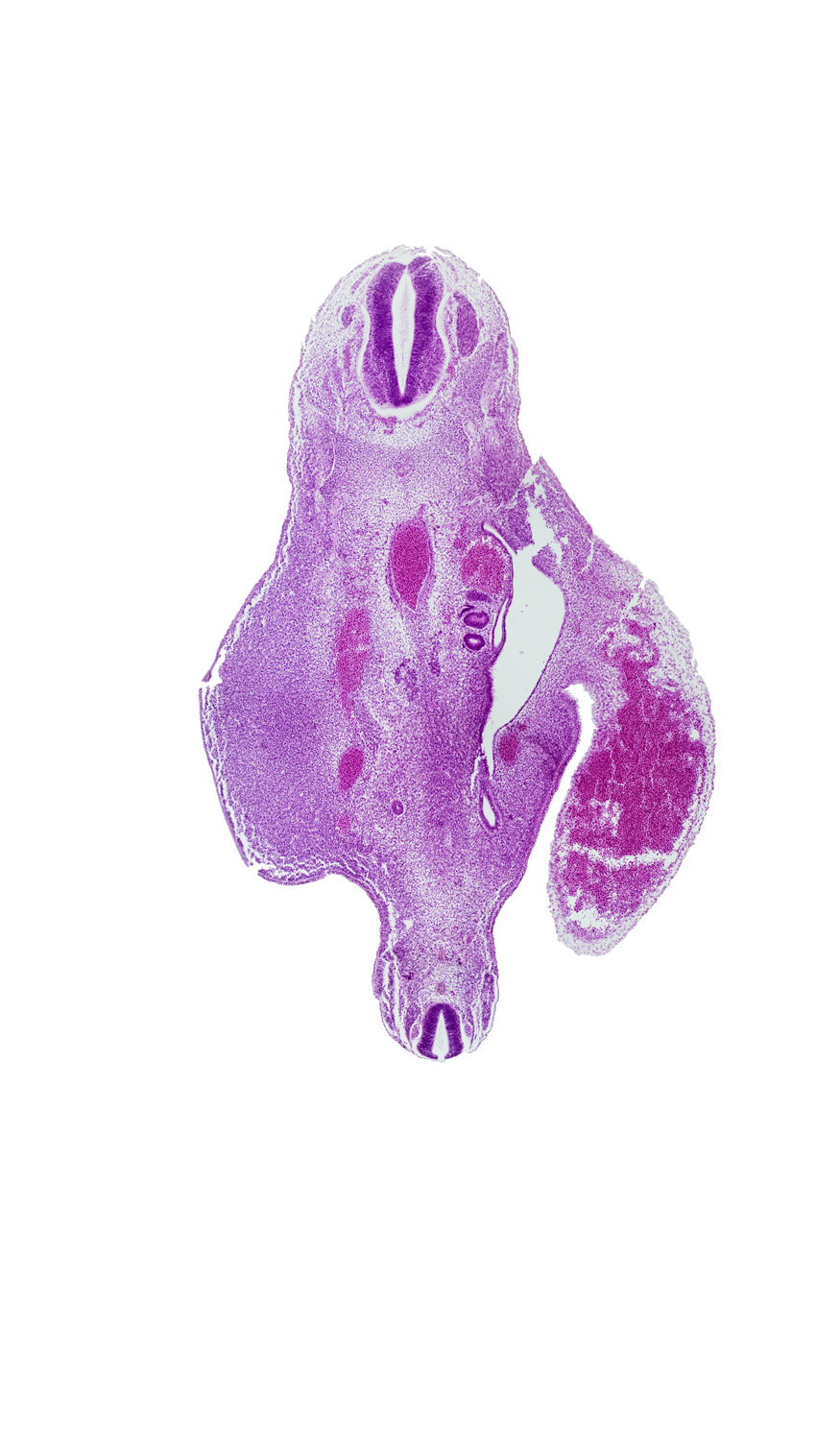 S-5 spinal ganglion, T-11 spinal ganglion, aorta, left umbilical vein, lower limb (gluteal region), mesonephric duct, mesonephric vesicle(s), metanephric diverticulum, notochord, peritoneal cavity, right umbilical artery, spinal cord