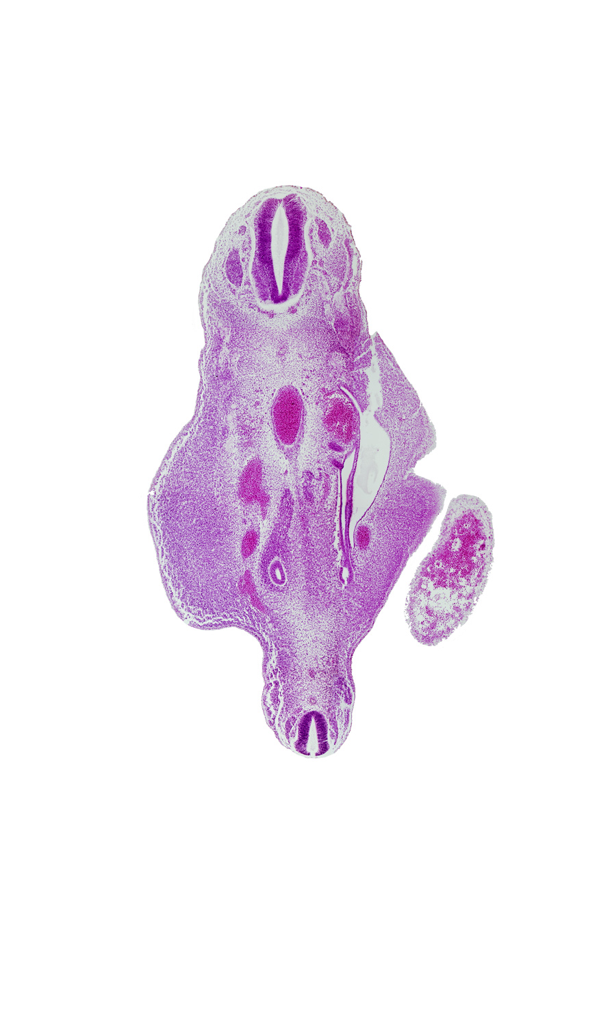 S-5 spinal ganglion, T-11 spinal ganglion, aorta, artifact tear, caudal edge of left umbilical vein, junction of mesonephric duct and metanephric diverticulum, kidney (metanephros) in presumptive pelvis, left umbilical artery, mesonephric duct, notochord