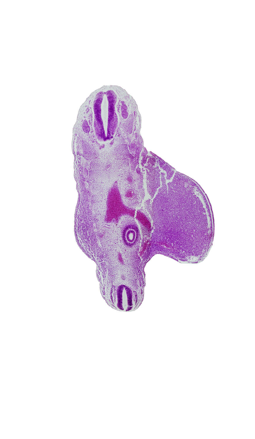 S-4 spinal ganglion, T-12 spinal ganglion, alar plate(s), aortic bifurcation, basal plate, central canal, common iliac artery, floor plate, gluteal part of lower limb, kidney (metanephros) in presumptive pelvis, marginal vein, notochord, roof plate