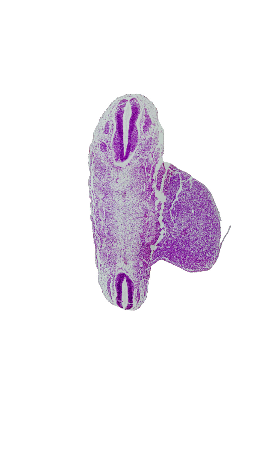 L-1 spinal ganglion, S-3 spinal ganglion, artifact fracture(s), lower limb, sclerotome, surface ectoderm