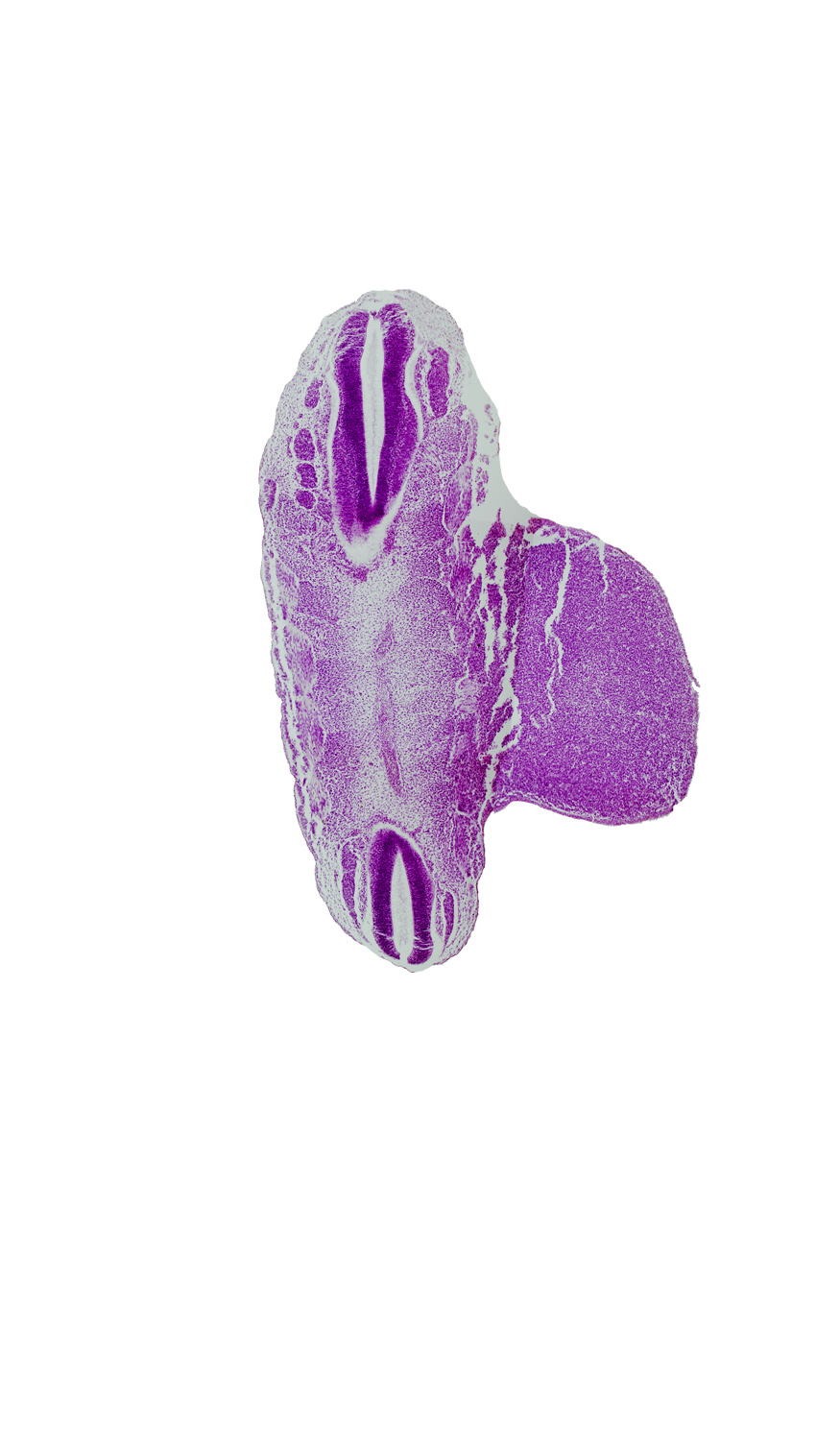 L-1 spinal ganglion, S-3 spinal ganglion, artifact separation(s), central canal, lower limb, notochord, sclerotome