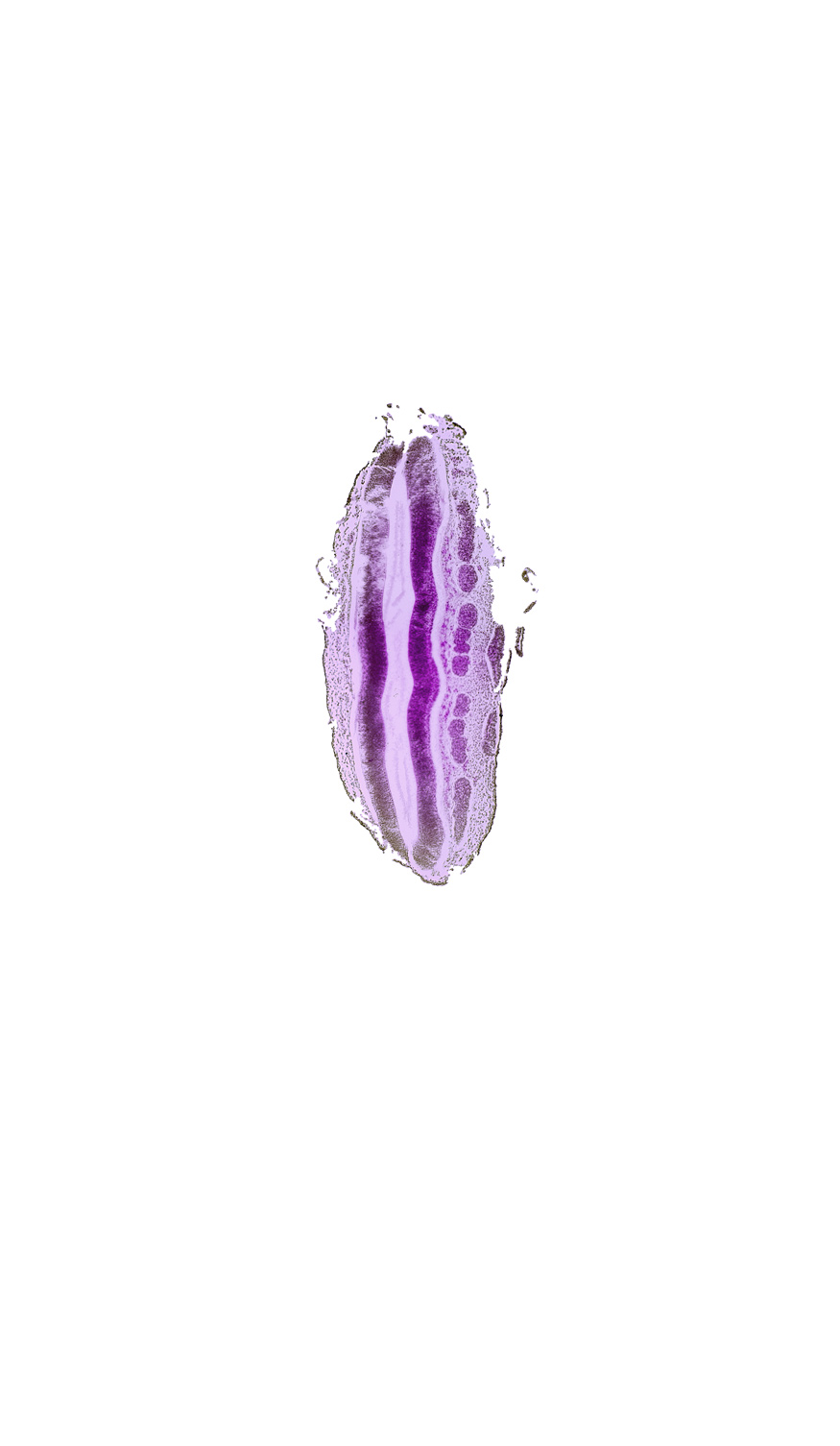 L-3 spinal ganglion, L-4 spinal ganglion, L-5 spinal ganglion, S-1 spinal ganglion, central canal, surface ectoderm