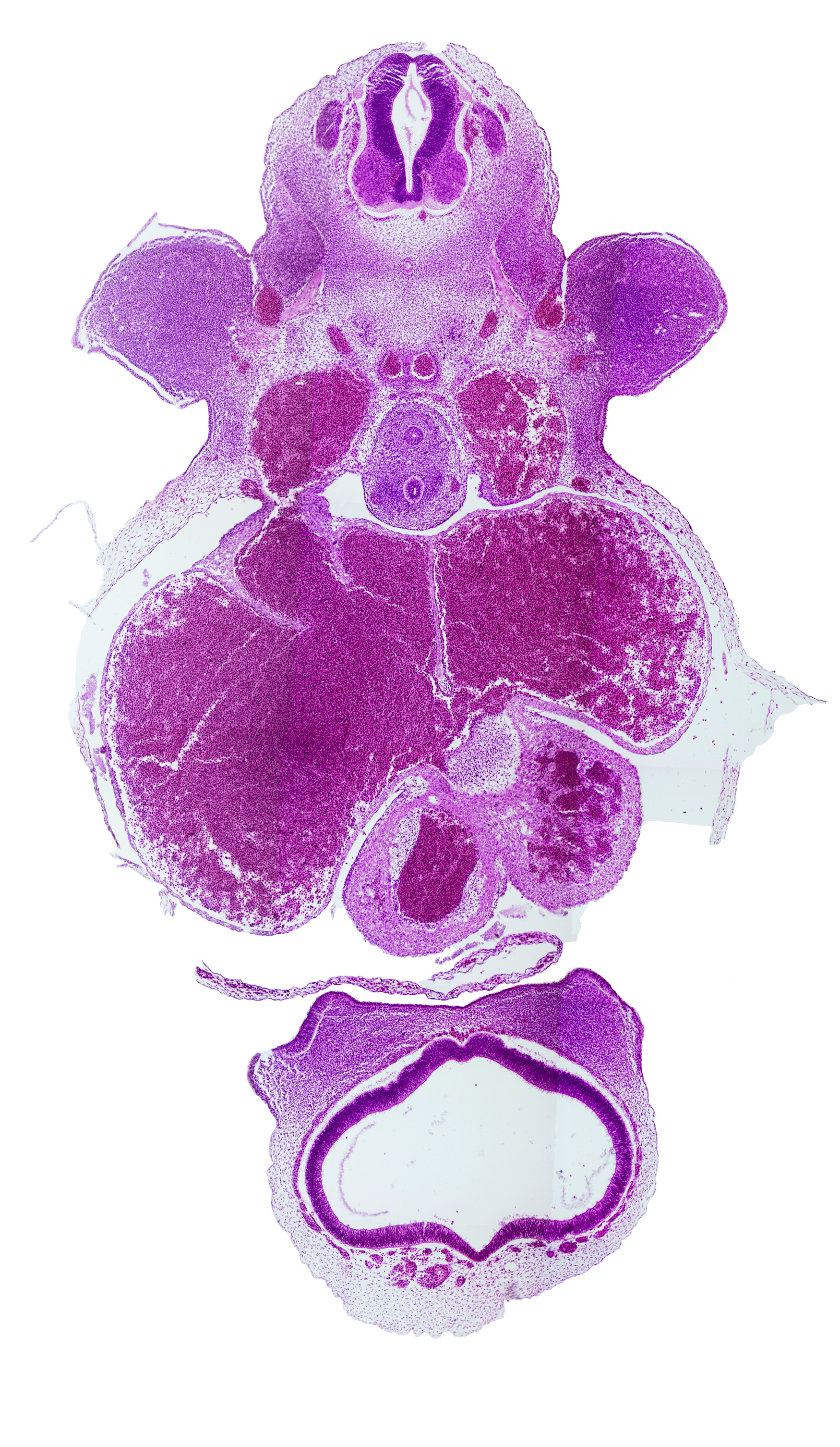 C-6 / C-7 interganglion region, cephalic part of nasal prominences, cerebral vesicle (telencephalon), hippocampus, junction of right common cardinal vein and sinus venosus, lateral ventricle, left atrium, left venous valve, left ventricle, marginal sinus, pericardial cavity, precardinal vein (internal jugular vein), primary interatrial septum (septum primum), right atrium, right venous valve, sinus venosus, spinal nerve(s), third ventricle, truncus arteriosus (outflow tract)