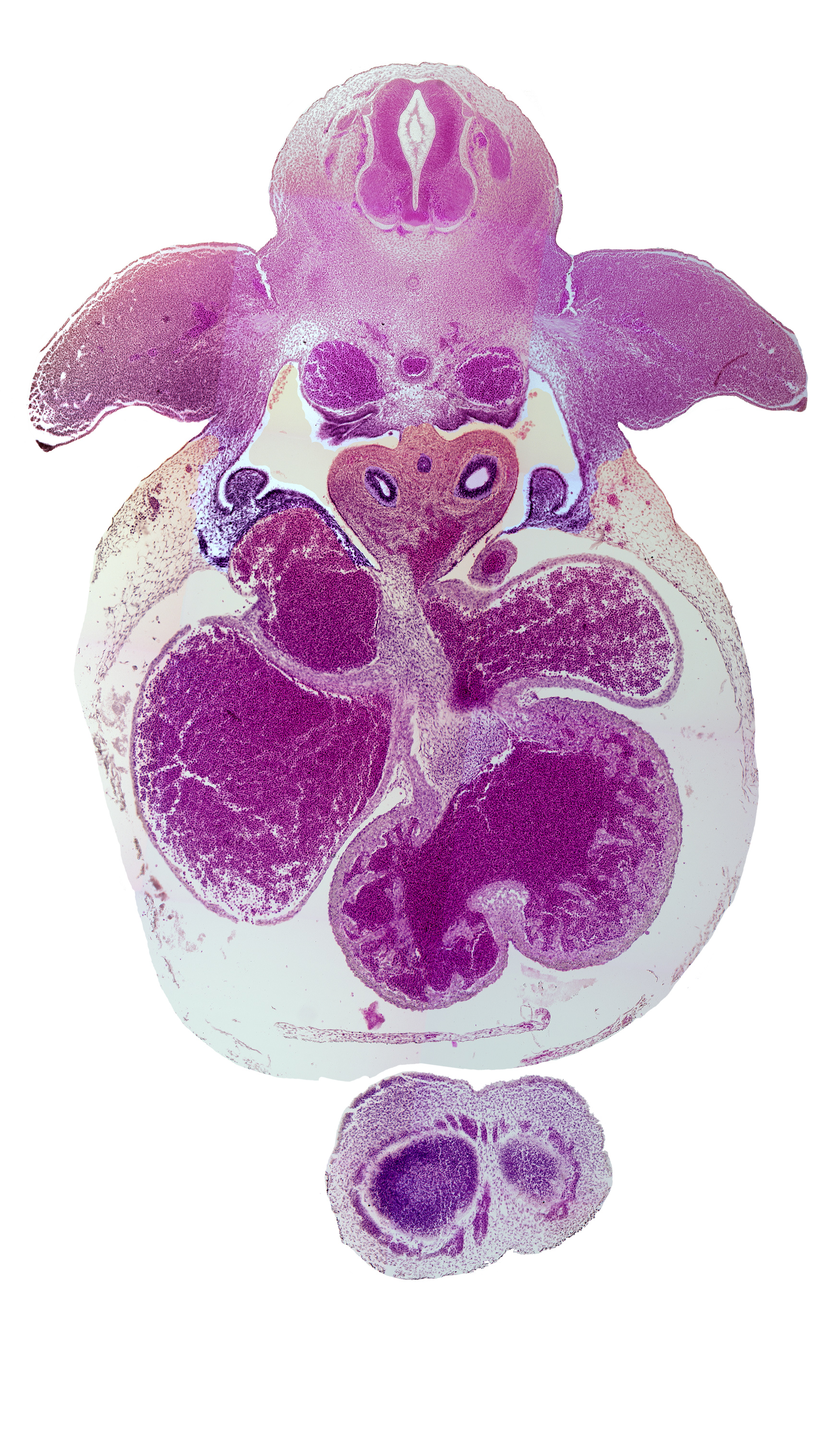 C-7 / C-8 interganglion region, aorta, apical epidermal ridge, common pulmonary vein, edge of cerebral vesicle(s), esophagus, interventricular foramen, interventricular sulcus, left atrioventricular canal, left atrium, left common cardinal vein, left ventricle, pericardioperitoneal canal (pleural cavity), pleuropericardial fold, postcardinal vein, right atrium, right ventricle, sinus venosus, trabecular part of left ventricle, vascular plexus