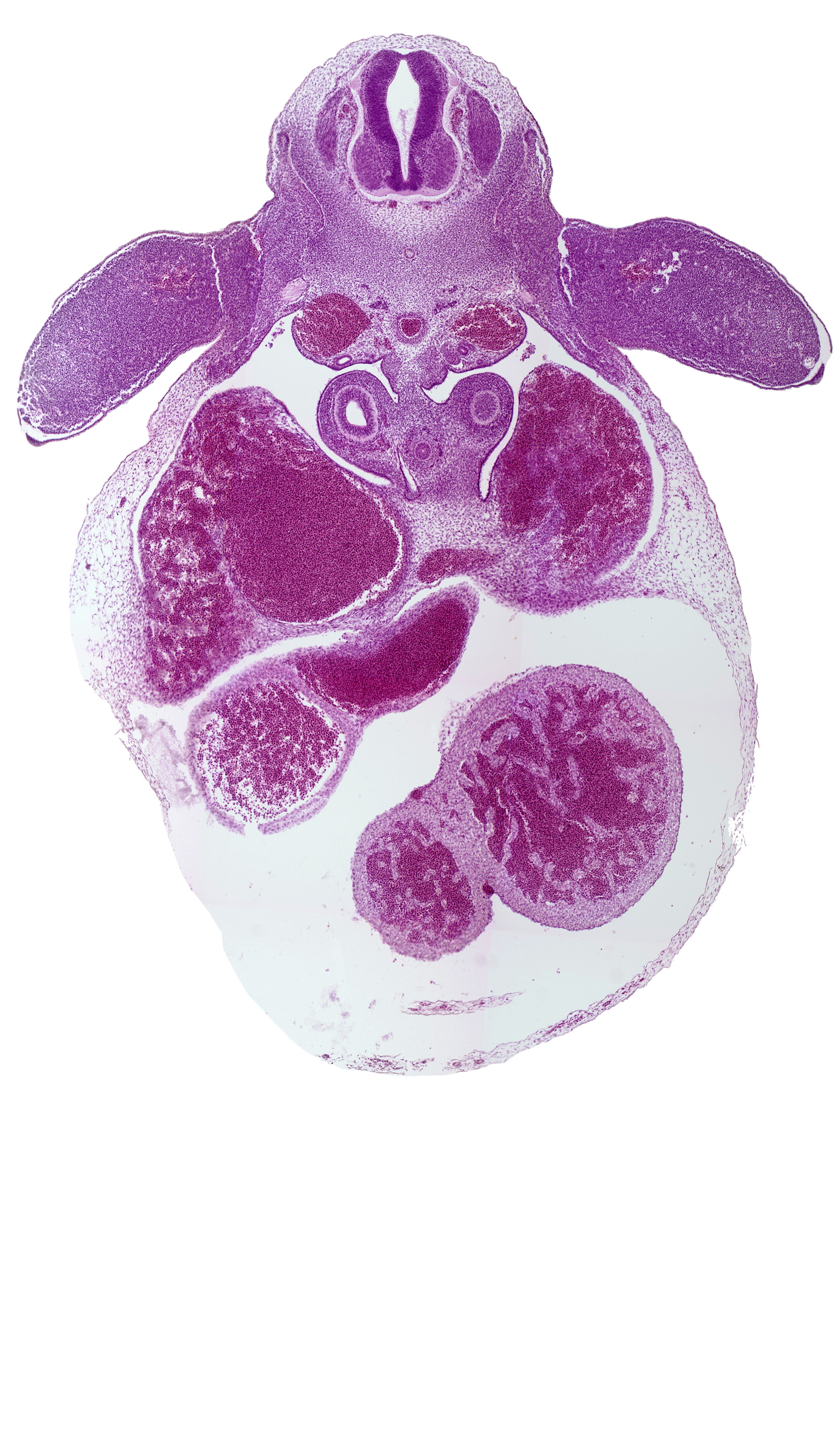 alar plate(s), aorta, basal plate, caudal edge of secondary bronchus bud, ductus venosus, esophagus, floor plate, interventricular sulcus, left ventricle, liver, mesonephros, pericardial cavity, postcardinal vein, right atrium, right ventricle, roof plate, sinus venosus, trabecular part of right ventricle, upper limb