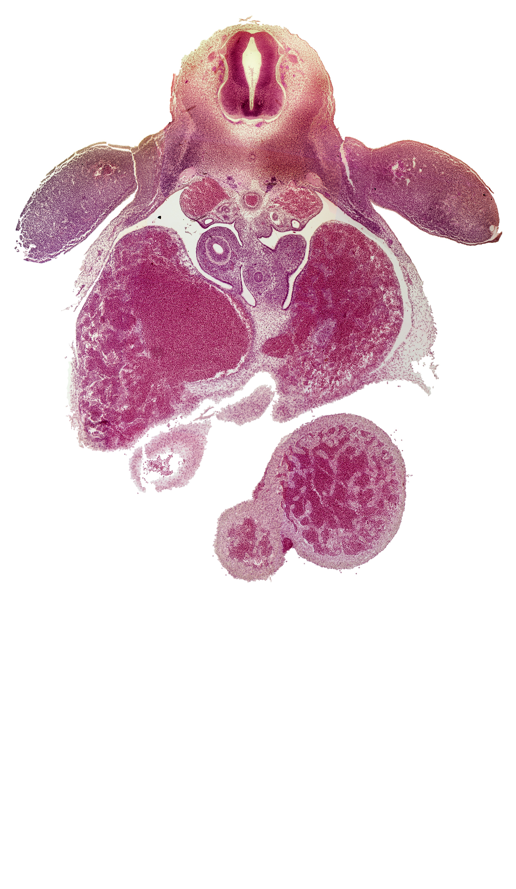 C-8 / T-1 interganglion region, caudal edge of right atrium, caudal edge of sinus venosus, ductus venosus, interventricular septum, left ventricle, liver, mesonephric duct, pericardial sac tear, peritoneal cavity, postcardinal vein, pulmogenic coat, right lower secondary bronchus, right ventricle