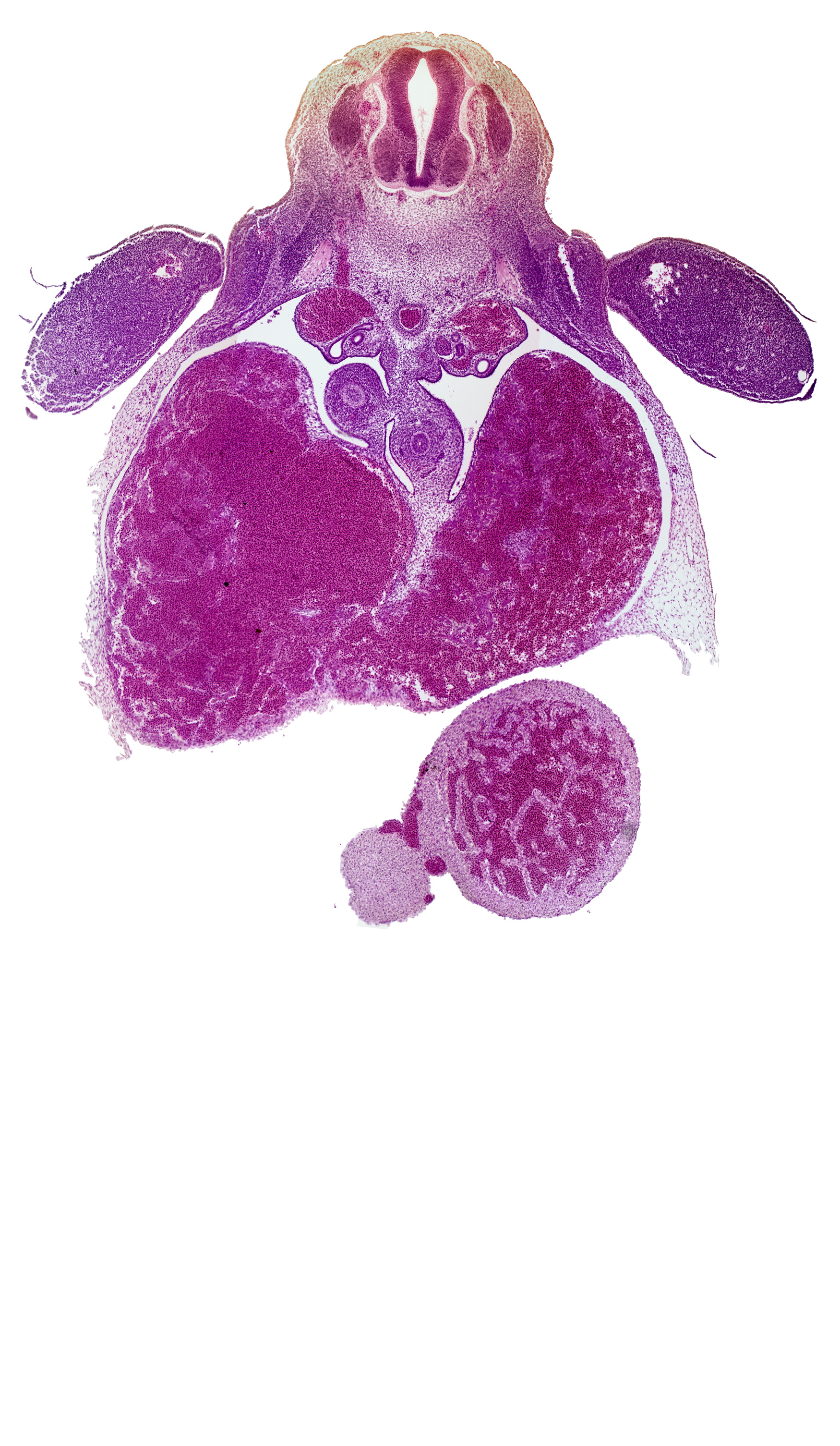 T-1 spinal ganglion, caudal edge of right lower secondary bronchus bud, caudal edge of right ventricle, central canal, ductus venosus, esophagus, left ventricle, liver, mesonephric duct