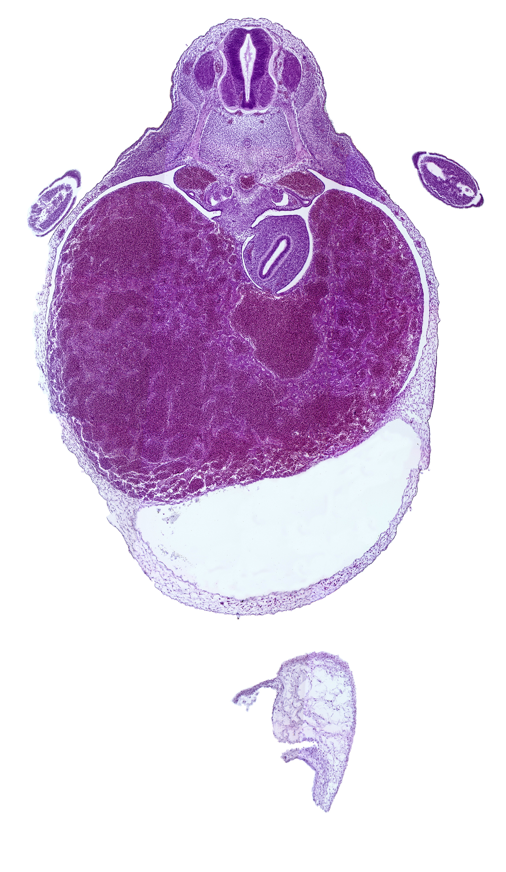 T-2 spinal ganglion, apical epidermal ridge, ductus venosus, hepatic sinusoid, marginal vein, mesonephric duct, neural arch blastema, pericardial cavity, pericardial sac, septum transversum, spinal nerve(s)