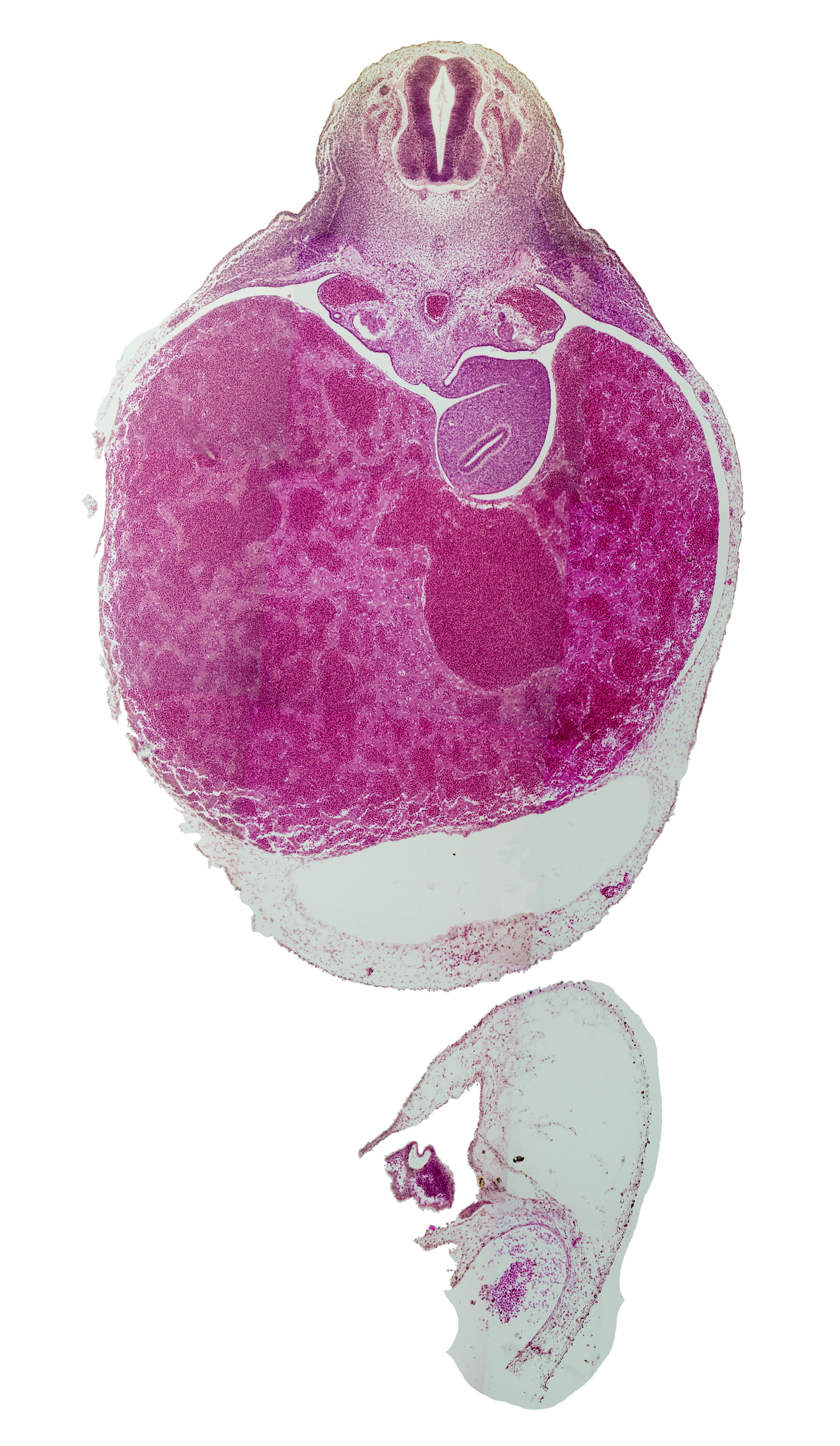 T-3 spinal ganglion, aorta, dorsal mesogastrium, ductus venosus, hepatic sinusoid, lesser sac (omental bursa), mesonephric duct, pericardial cavity, spleen primordium, stomach