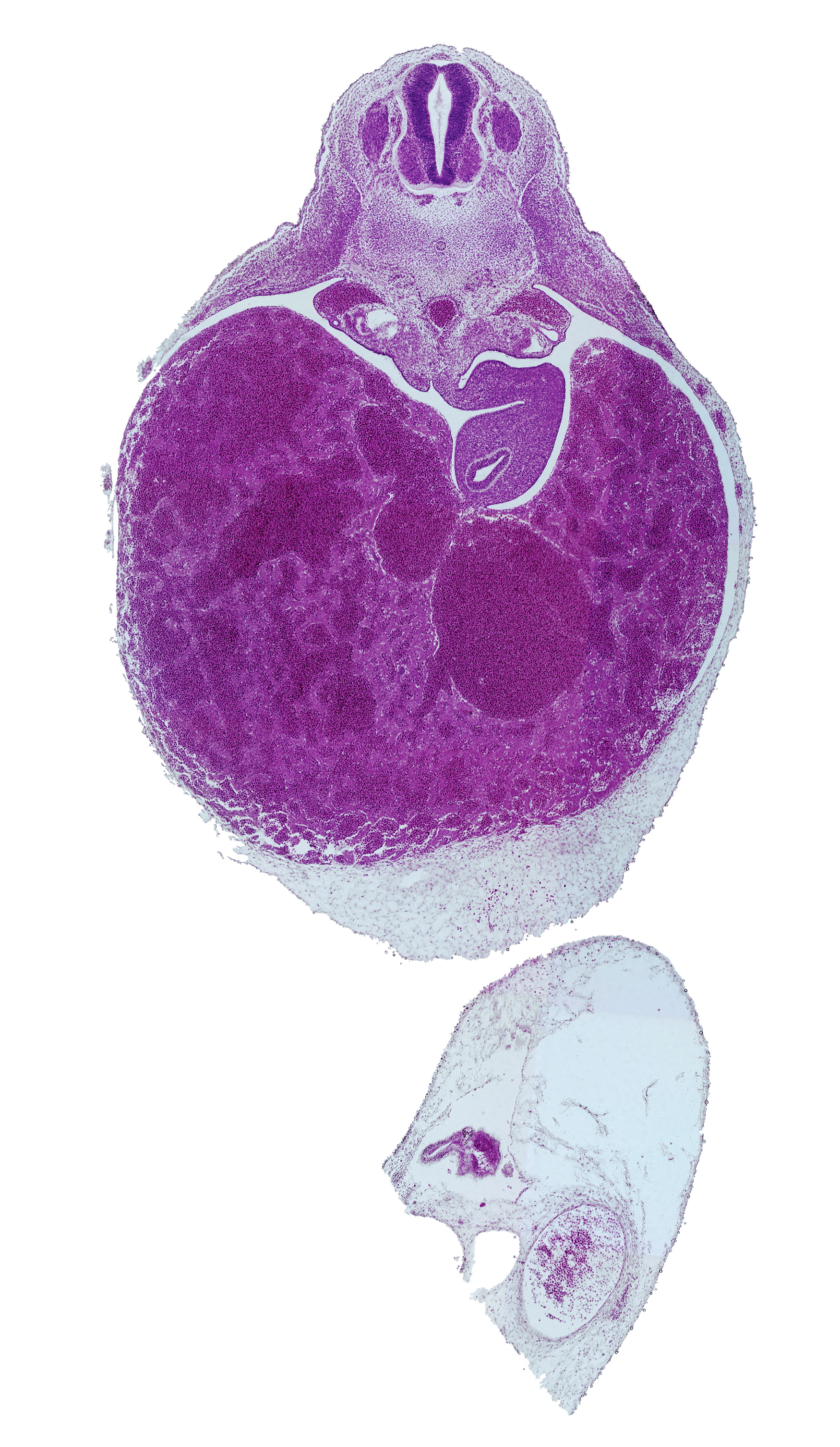 T-3 spinal ganglion, aorta, celiac artery, ductus venosus, intermediate zone, lesser sac (omental bursa), liver, marginal zone, mesonephric duct, notochord, peritoneal cavity, septum transversum, spleen primordium, stomach, suprarenal gland primordium