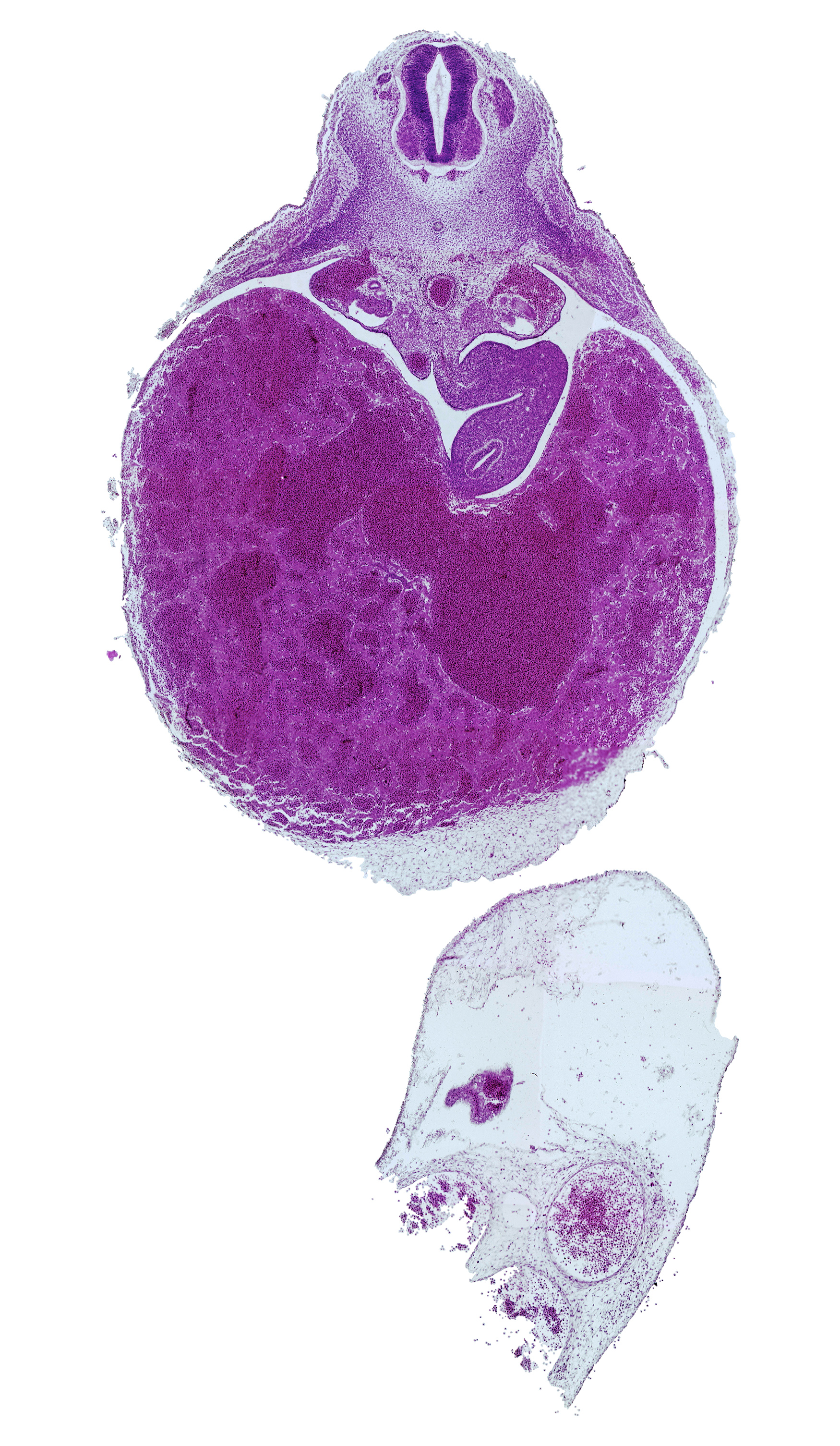 T-3 spinal ganglion, aorta, ductus venosus, greater sac, junction of duodenum and stomach, lesser sac (omental bursa), liver, neural arch blastema, omental foramen, postcardinal vein, rib blastema, spleen primordium, ventral body wall