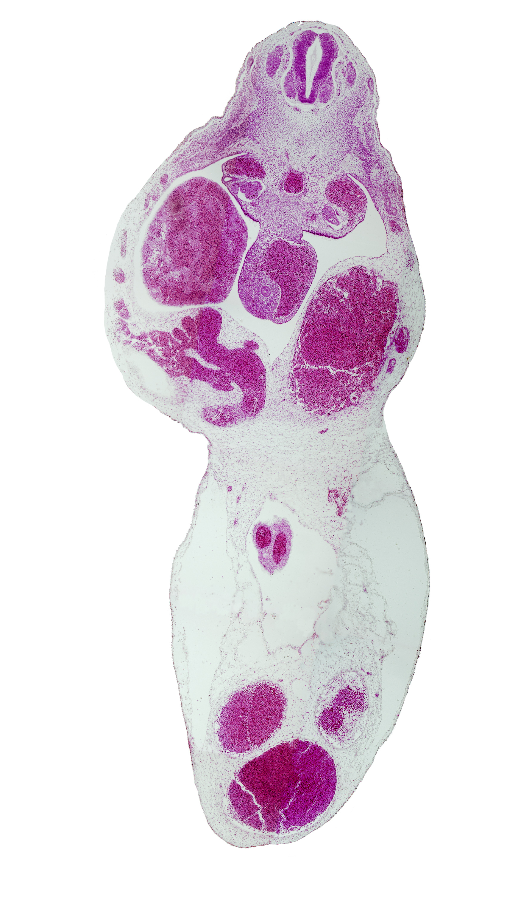 T-5 / T-6 interganglion region, aorta, cephalic edge of gonadal ridge, left umbilical artery, liver, midgut, right umbilical artery, umbilical vein, vitelline (omphalomesenteric) artery, vitelline (omphalomesenteric) vein