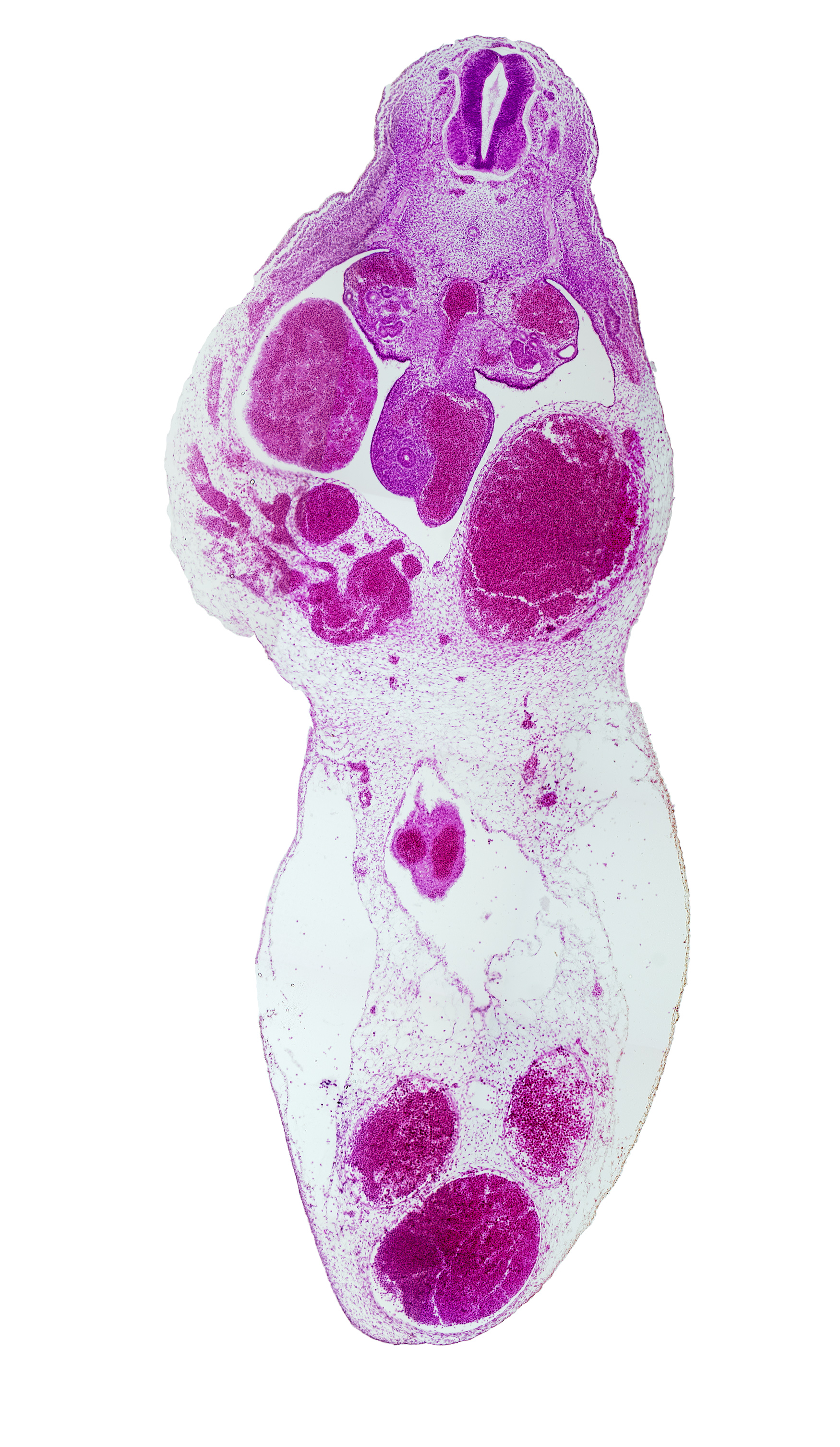 alar plate(s), allantois, aorta, basal plate, cephalic edge of T-6 spinal ganglion, floor plate, gonadal ridge, left umbilical artery, left umbilical vein (congested), mesonephric duct, mesonephric tubule(s), midgut, right umbilical artery, roof plate, sulcus limitans, superior mesenteric artery, umbilical coelom, umbilical vein, vitelline (omphalomesenteric) artery, vitelline (omphalomesenteric) vein