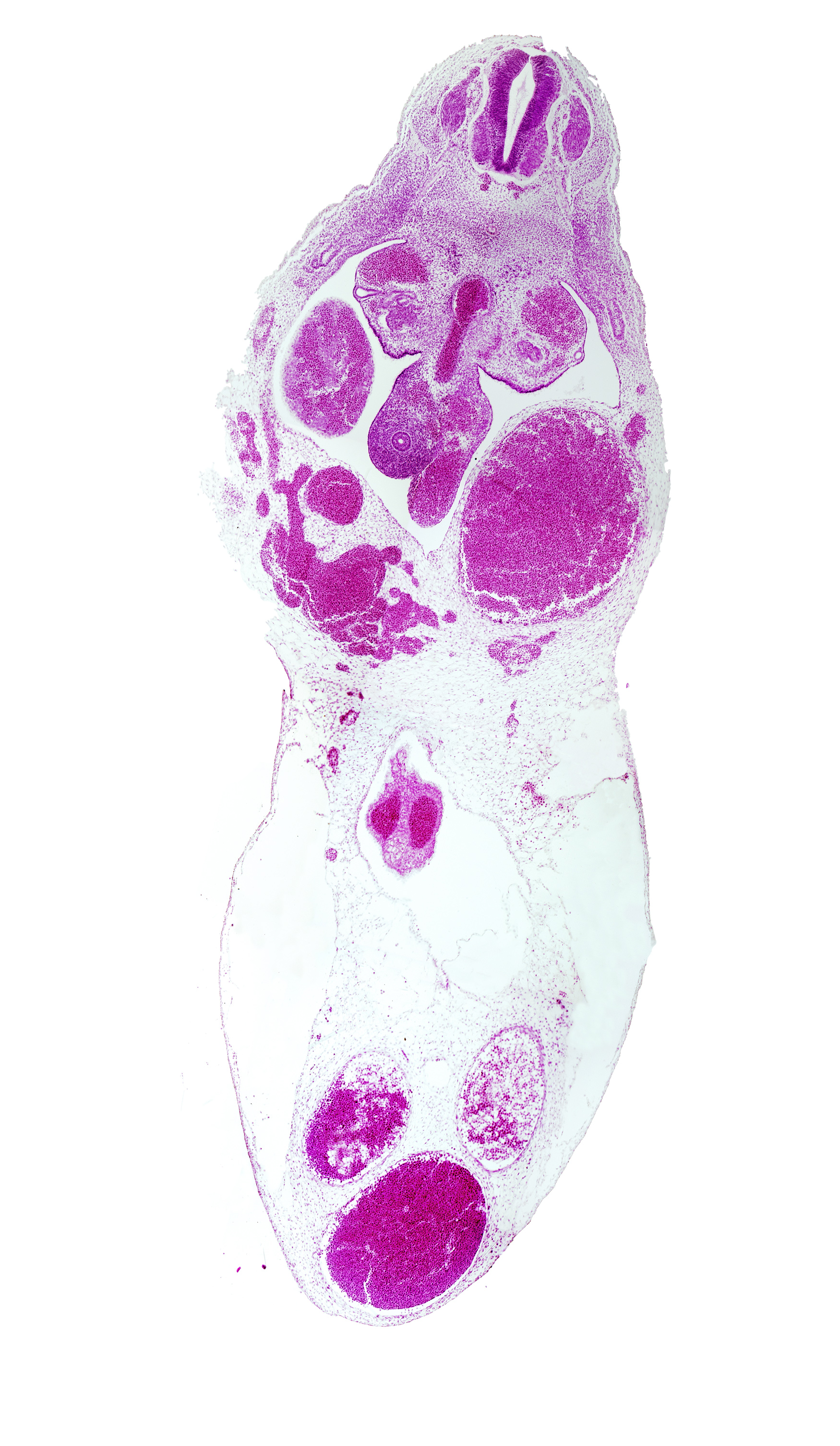 T-6 spinal ganglion, gonadal ridge, left umbilical artery, left umbilical vein (congested), liver, midgut, origin of superior mesenteric artery from aorta, right umbilical artery, right umbilical vein, umbilical cord, umbilical vein, vitelline (omphalomesenteric) artery, vitelline (omphalomesenteric) vein