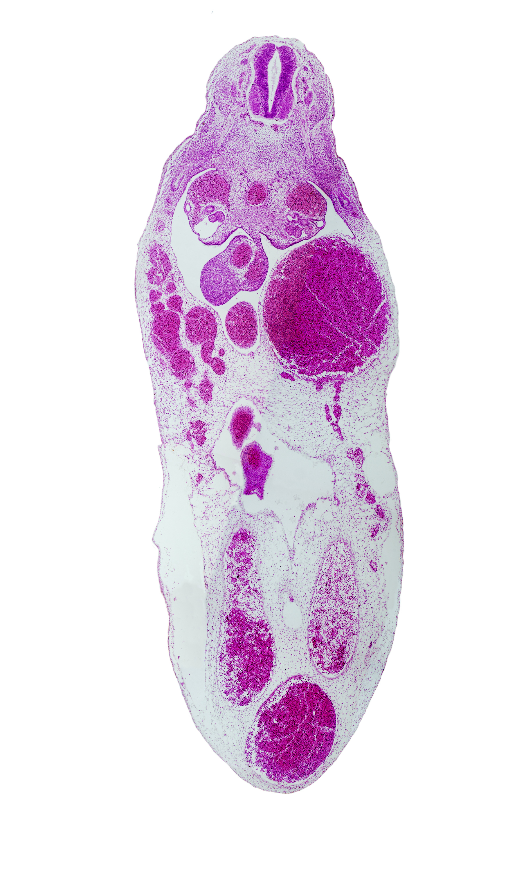 aorta, cephalic edge of T-7 spinal ganglion, left umbilical artery, left umbilical vein (congested), mesonephric duct, midgut, right umbilical artery, right umbilical vein, superior mesenteric artery, umbilical coelom, umbilical cord, umbilical intestinal loop, umbilical vein, vitelline (omphalomesenteric) artery, vitelline (omphalomesenteric) vein