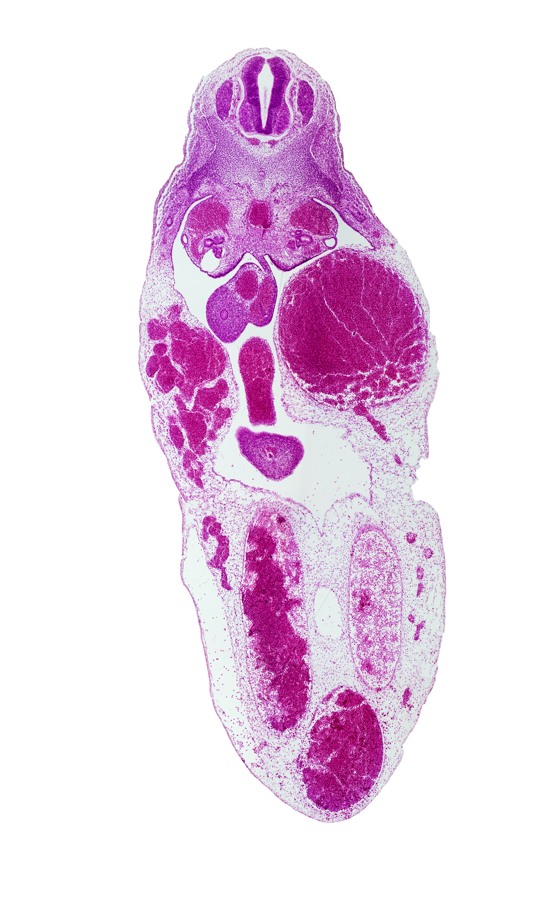 T-7 spinal ganglion, allantois, gonadal ridge, left umbilical vein (congested), mesonephric duct, midgut, right umbilical vein, superior mesenteric artery, vitelline (omphalomesenteric) vein