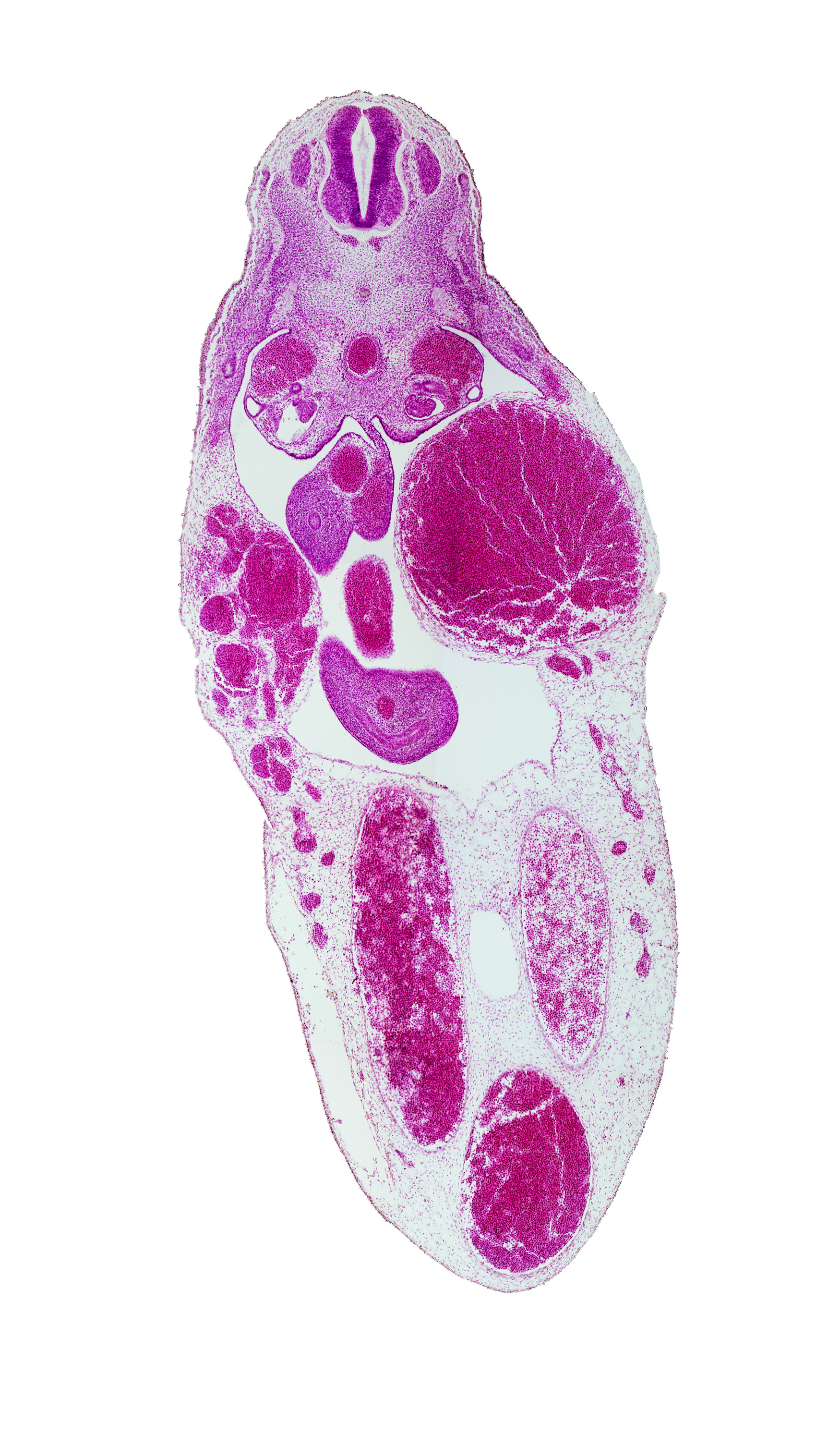 T-7 spinal ganglion, aorta, gonadal ridge, left umbilical artery, left umbilical vein (congested), mesonephric duct, midgut, postcardinal vein, right umbilical artery, superior mesenteric artery, umbilical vein