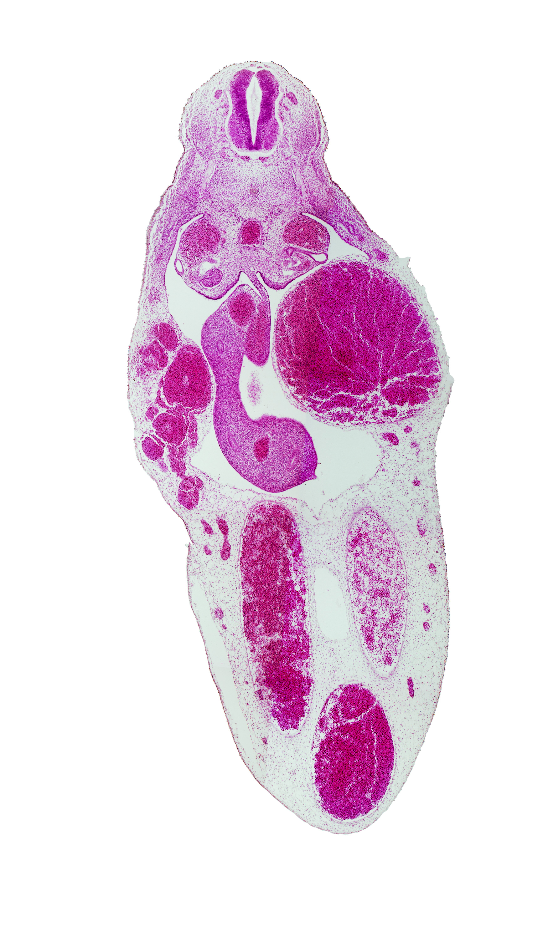 T-7 / T-8 interganglion region, dorsal mesentery, left umbilical artery, mesentery, midgut, neural arch blastema, neural canal, right umbilical artery, spinal nerve(s), superior mesenteric artery, umbilical vein