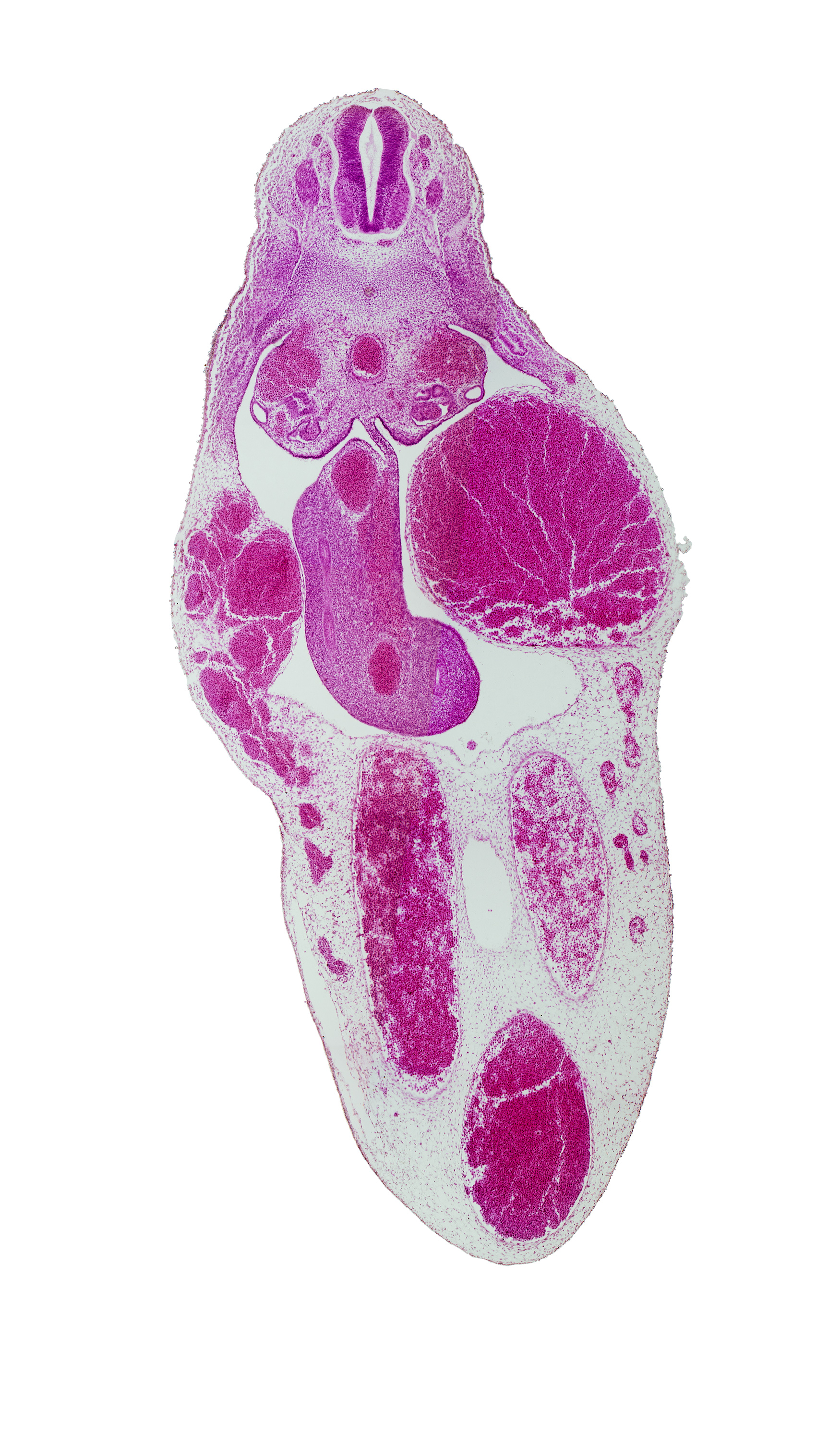 T-8 spinal ganglion, allantois, aorta, central canal, floor plate, gonadal epithelium, left umbilical artery, mesentery, mesonephric duct, midgut, notochord, right umbilical artery, roof plate, superior mesenteric artery, umbilical vein