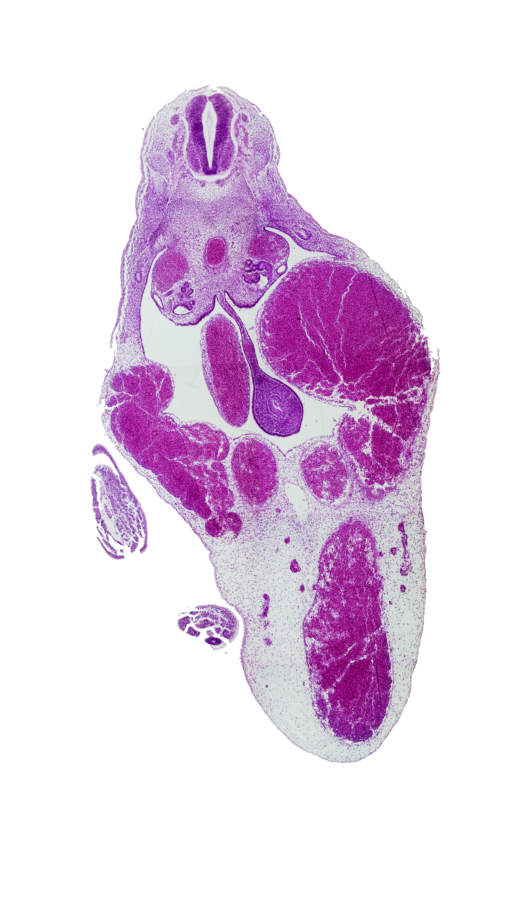 T-8 / T-9 interganglion region, amnion, aorta, caecal swelling, caudal eminence, dorsal mesentery, left umbilical vein, lower limb (distal part), mesonephric duct, postcardinal vein, superior mesenteric artery, surface ectoderm, umbilical cord, umbilical vein