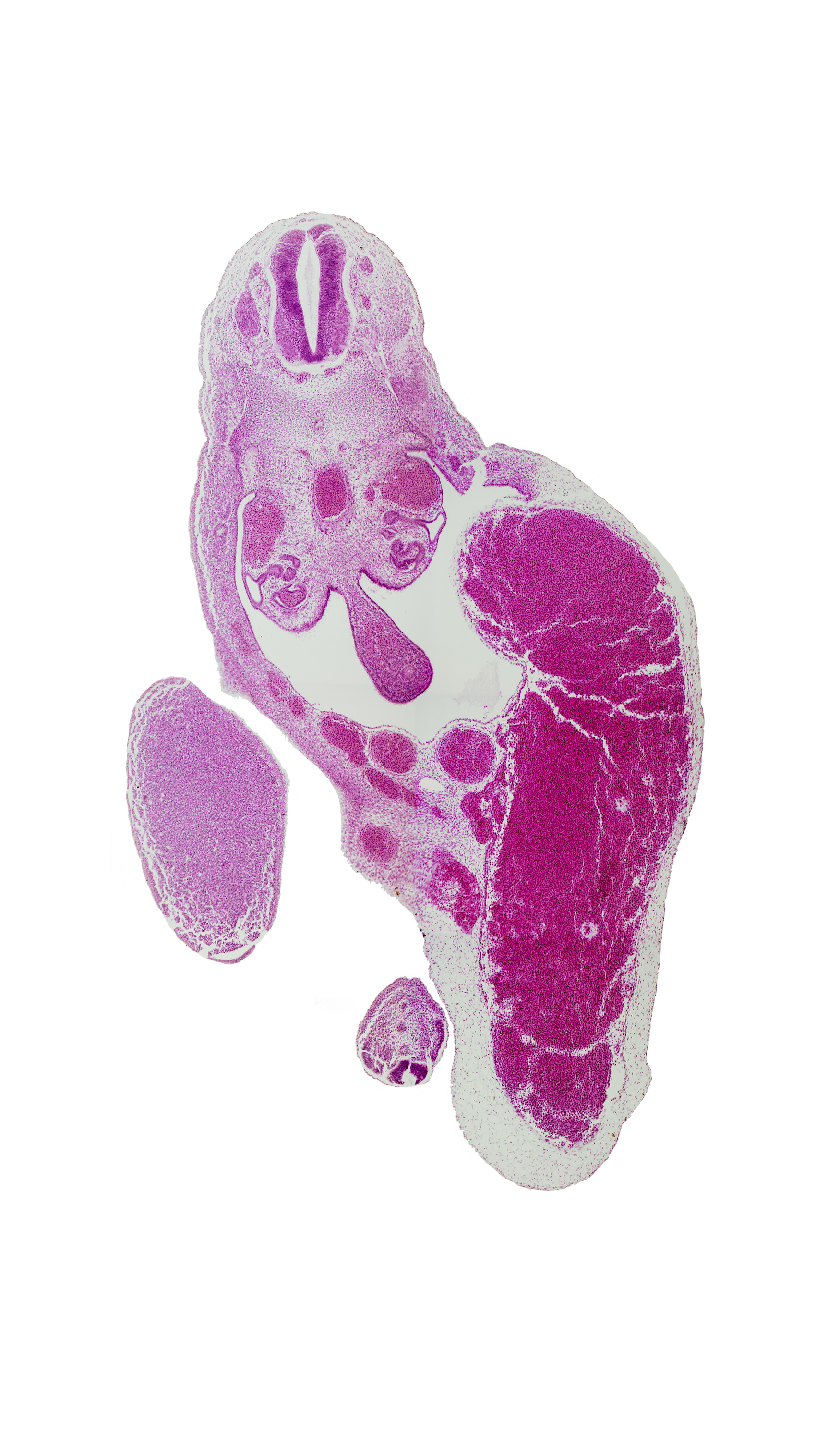 T-9 / T-10 interganglion region, allantois, aorta, caudal eminence, gonadal ridge, junction of hindgut and midgut, left umbilical artery, left umbilical vein (congested), mesonephric duct, neural tube, peritoneal cavity, right umbilical artery