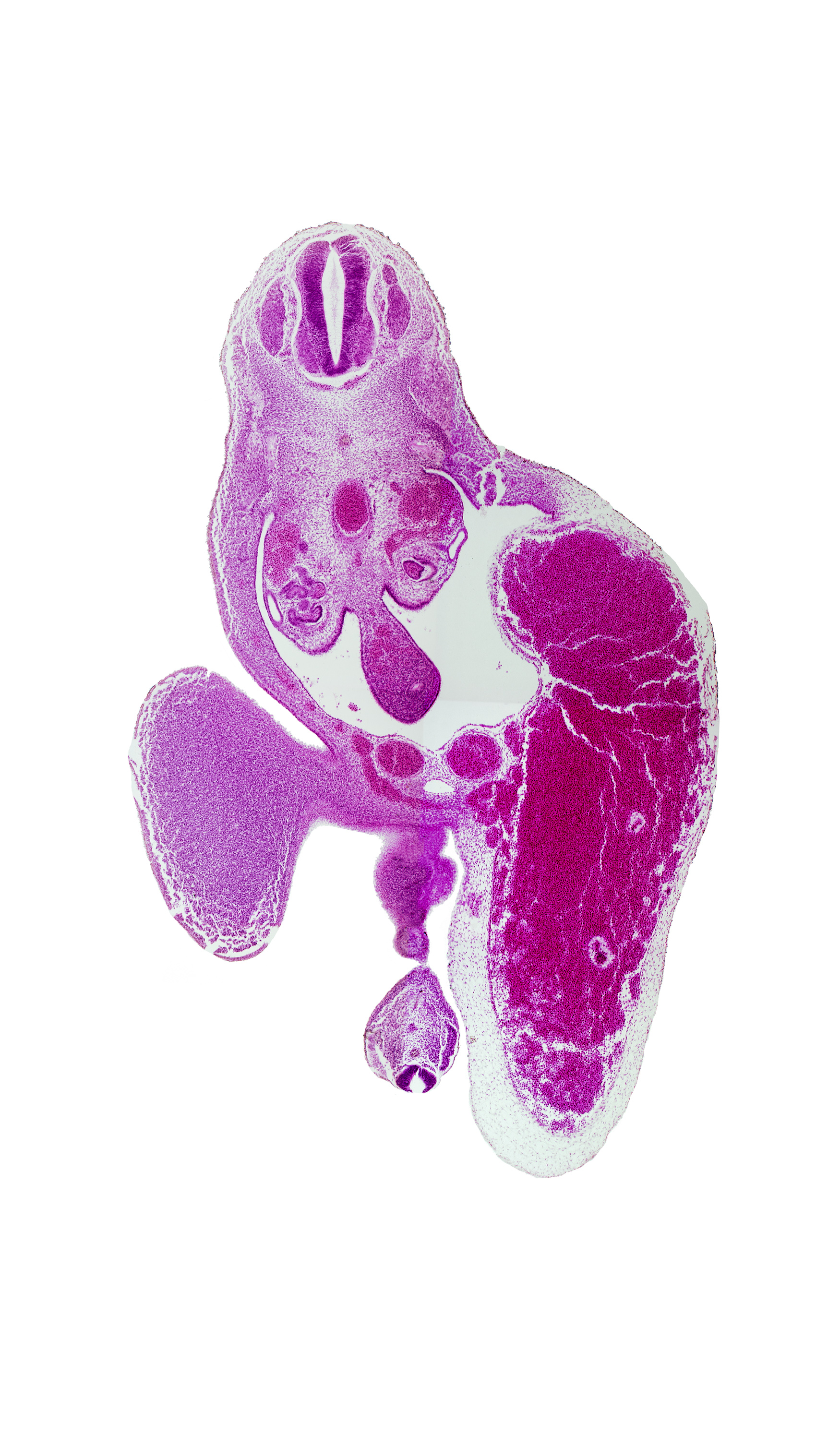 T-10 spinal ganglion, allantois, caudal eminence, hindgut, junction of body wall and lower limb, left umbilical artery, left umbilical vein (congested), lower limb (proximal part), mesonephric duct, notochord, peritoneal cavity, presumptive external genitalia, spinal cord