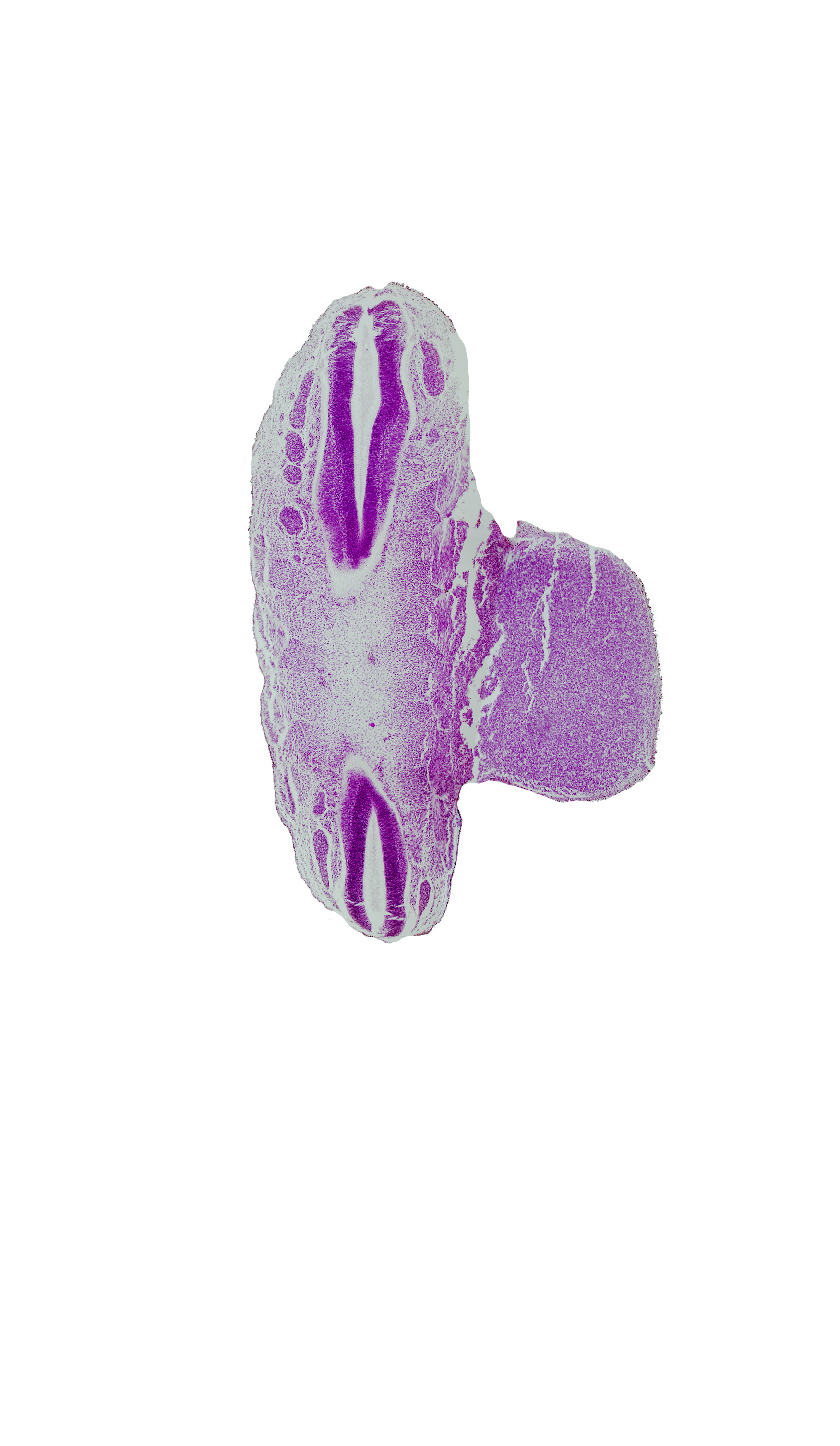 L-1 spinal ganglion, S-3 spinal ganglion, central canal, intermediate zone, marginal zone, sclerotome, ventricular zone