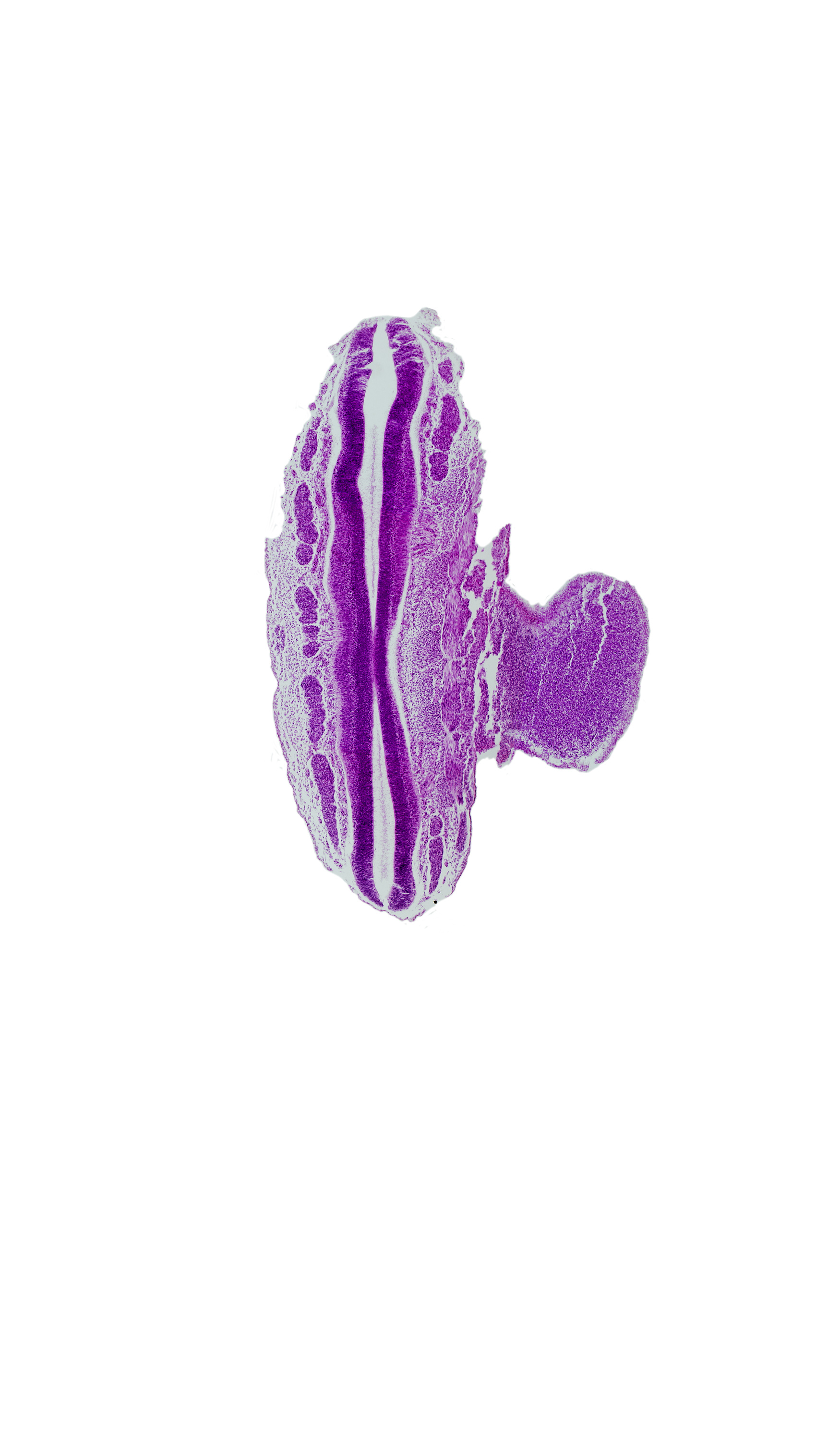 L-1 spinal ganglion, L-2 spinal ganglion, S-2 spinal ganglion, junction of central canal