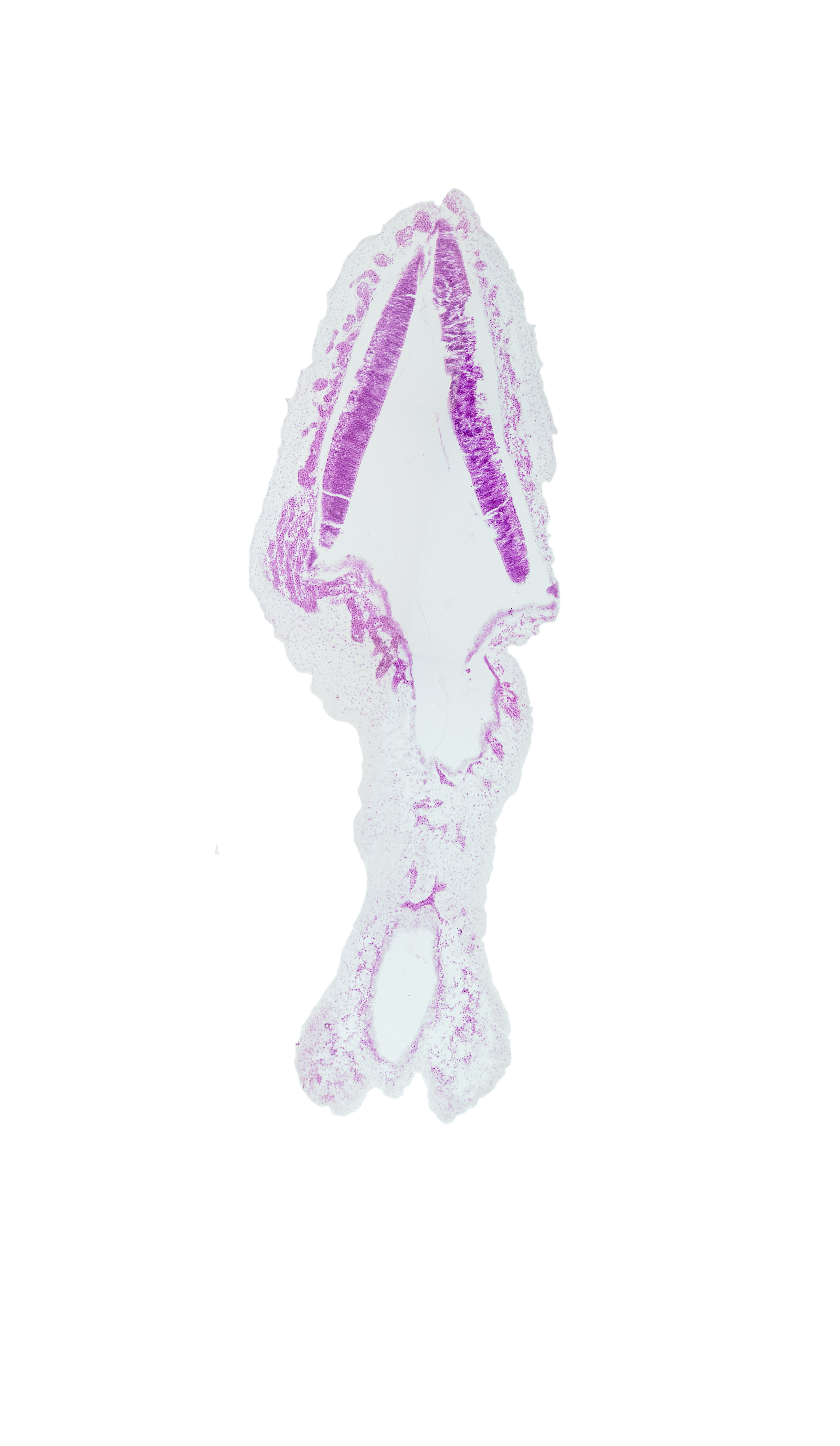 alar plate of rhombencephalon (cerebellum), cephalic edge of rhombencoel (fourth ventricle), rhombencoel (fourth ventricle), roof plate of rhombencephalon, surface ectoderm, vascular plexus