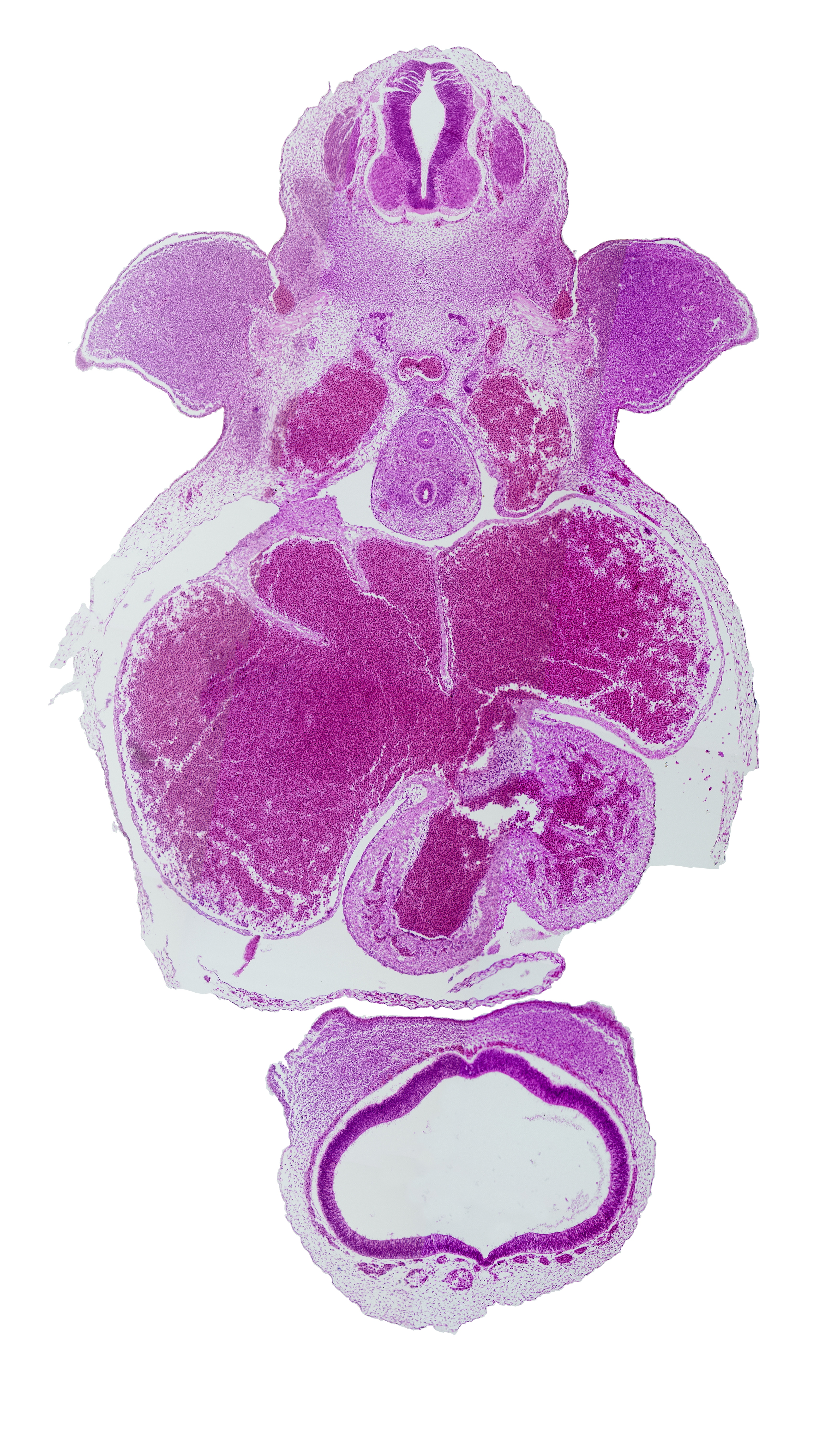 C-7 spinal ganglion, apical epidermal ridge, cephalic edge of nasal prominences, esophagus, hippocampus, junction of cardinal vein and common cardinal vein, junction of dorsal aortas, left venous valve, left ventricle, musculi pectinati, precardinal vein (internal jugular vein), primary interatrial foramen (foramen primum), primary interatrial septum (septum primum), right atrium, right venous valve, sinu-atrial foramen, sinus venosus, telencephalon medium, trachea
