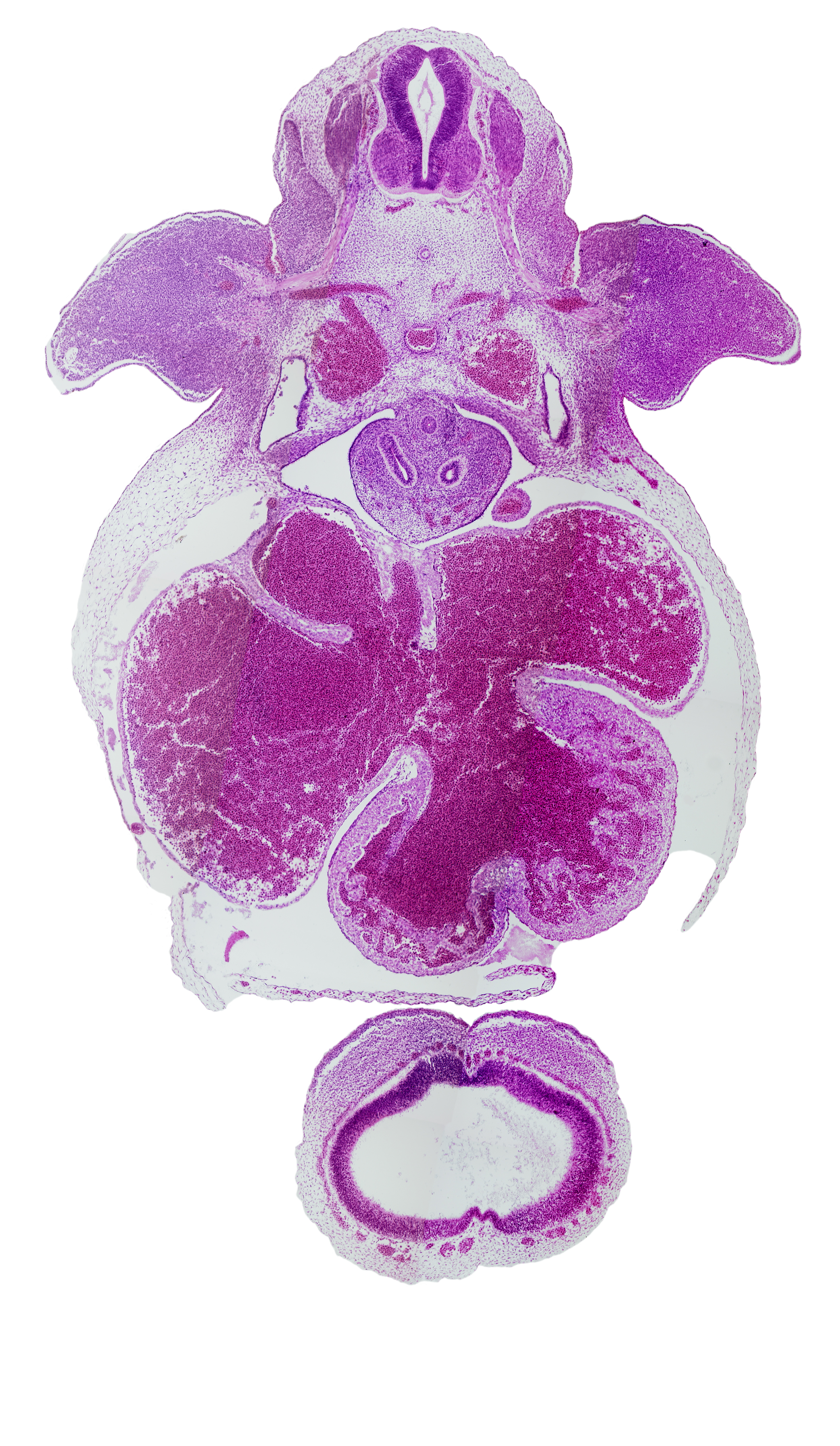 C-7 spinal ganglion, cephalic edge of peritoneal cavity, common atrioventricular canal, esophagus, interventricular foramen, lamina terminalis, lateral ventricle, left atrium, left primary bronchus, left venous valve, left ventricle, pericardioperitoneal canal (pleural cavity), postcardinal vein, primary interatrial septum (septum primum), pulmonary venous plexus, right atrium, right upper secondary bronchus bud, right venous valve, right ventricle, trabecular part of left ventricle, trabecular part of right ventricle