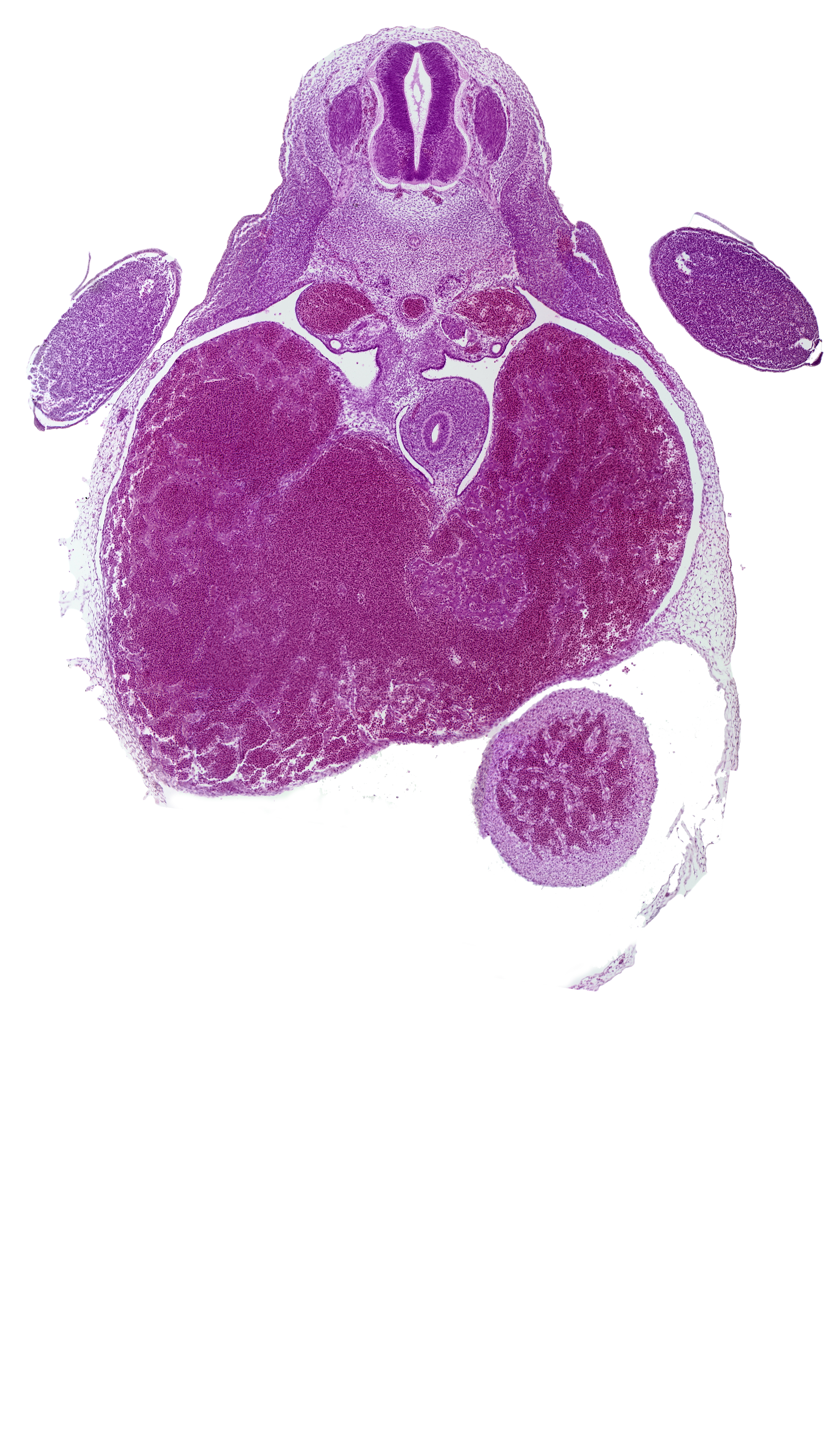 T-1 spinal ganglion, apical epidermal ridge, ductus venosus, left ventricle, liver, marginal vein, pericardial cavity, postcardinal vein