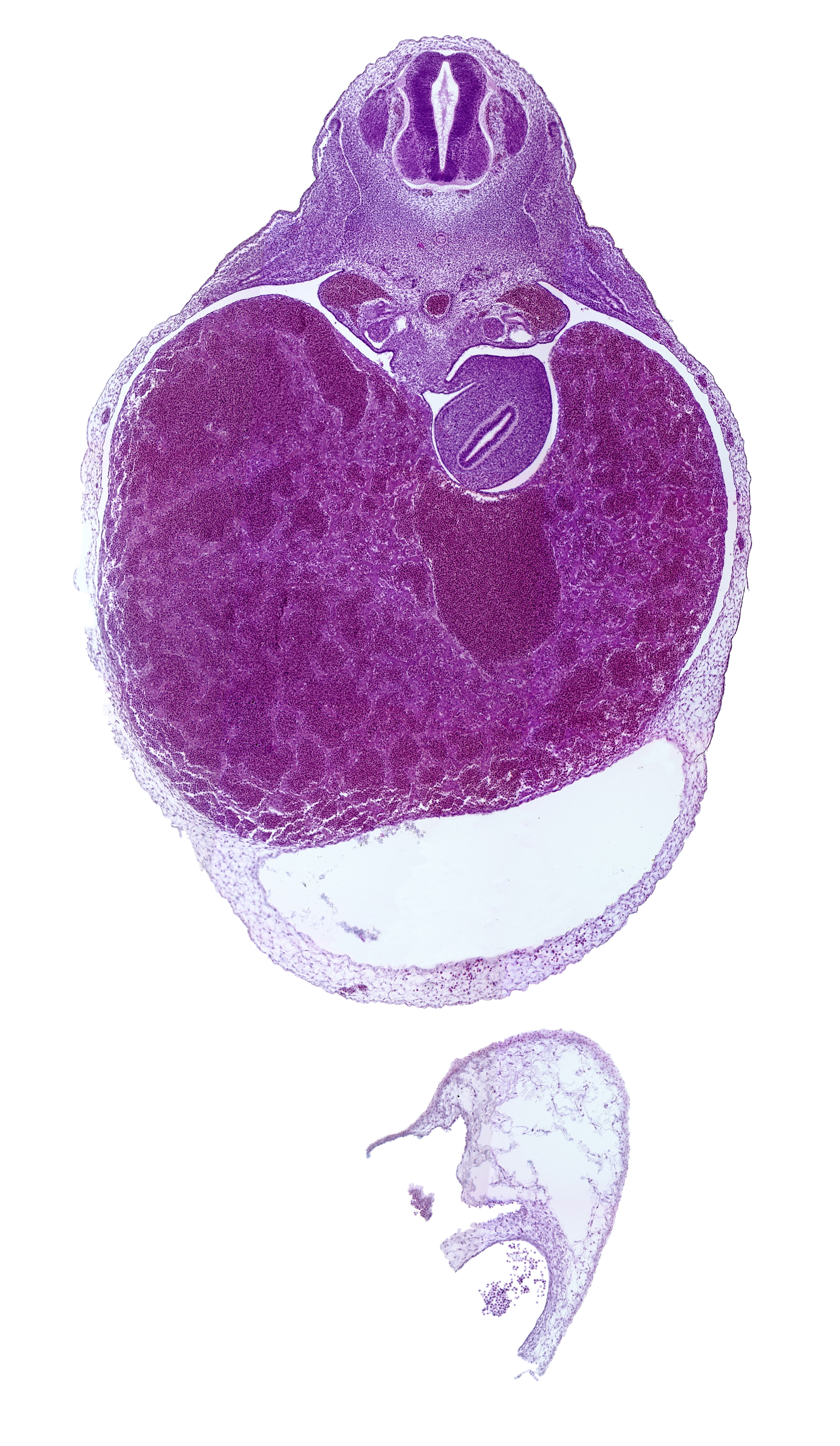 T-2 spinal ganglion, aorta, ductus venosus, liver, pericardial cavity, peritoneal cavity, postcardinal vein