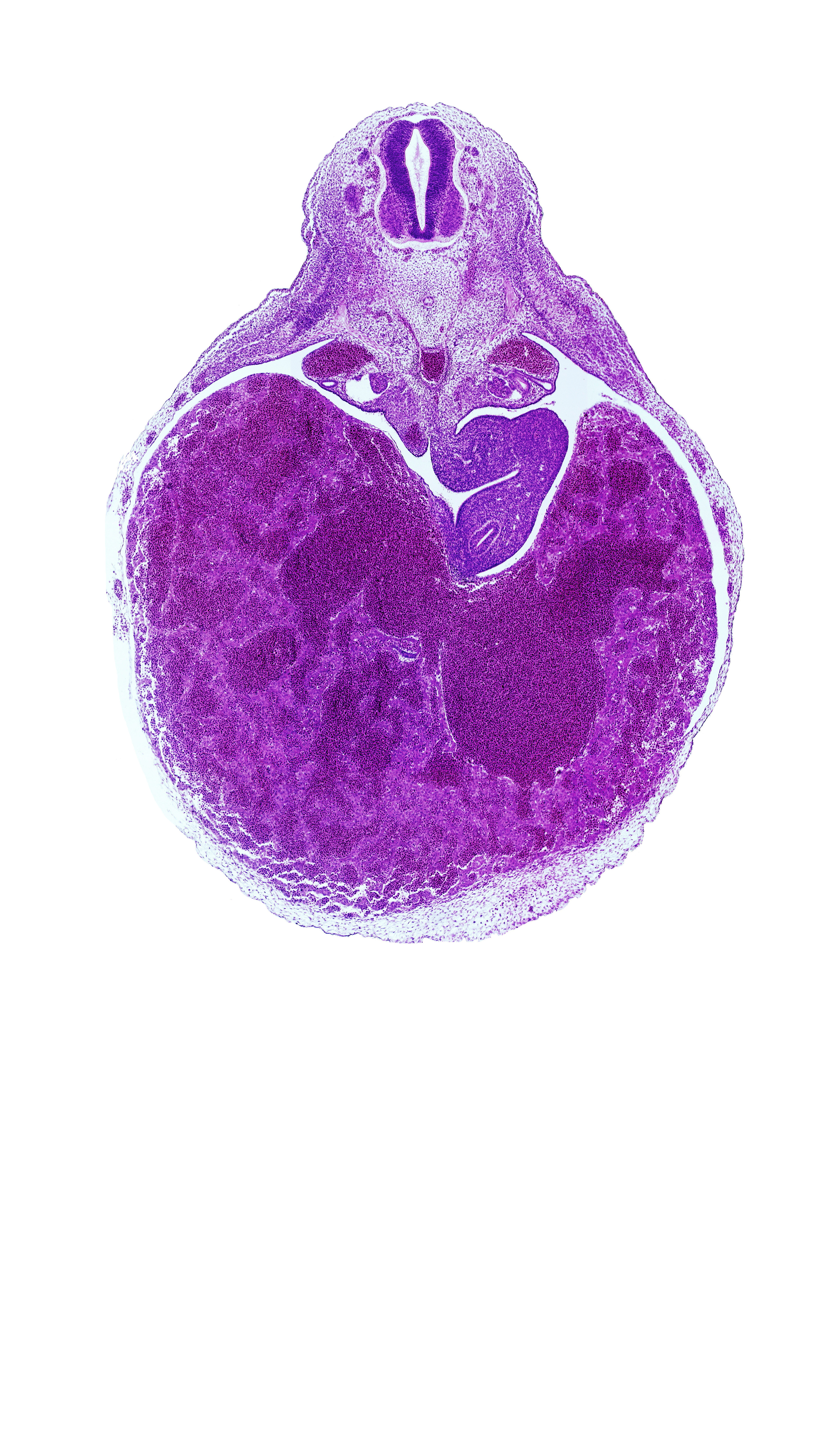 T-3 / T-4 interganglion region, aorta, dorsal mesogastrium, ductus venosus, duodenum, left hepatic vein, liver, mesonephric duct, neural arch blastema, omental foramen, postcardinal vein, right hepatic vein
