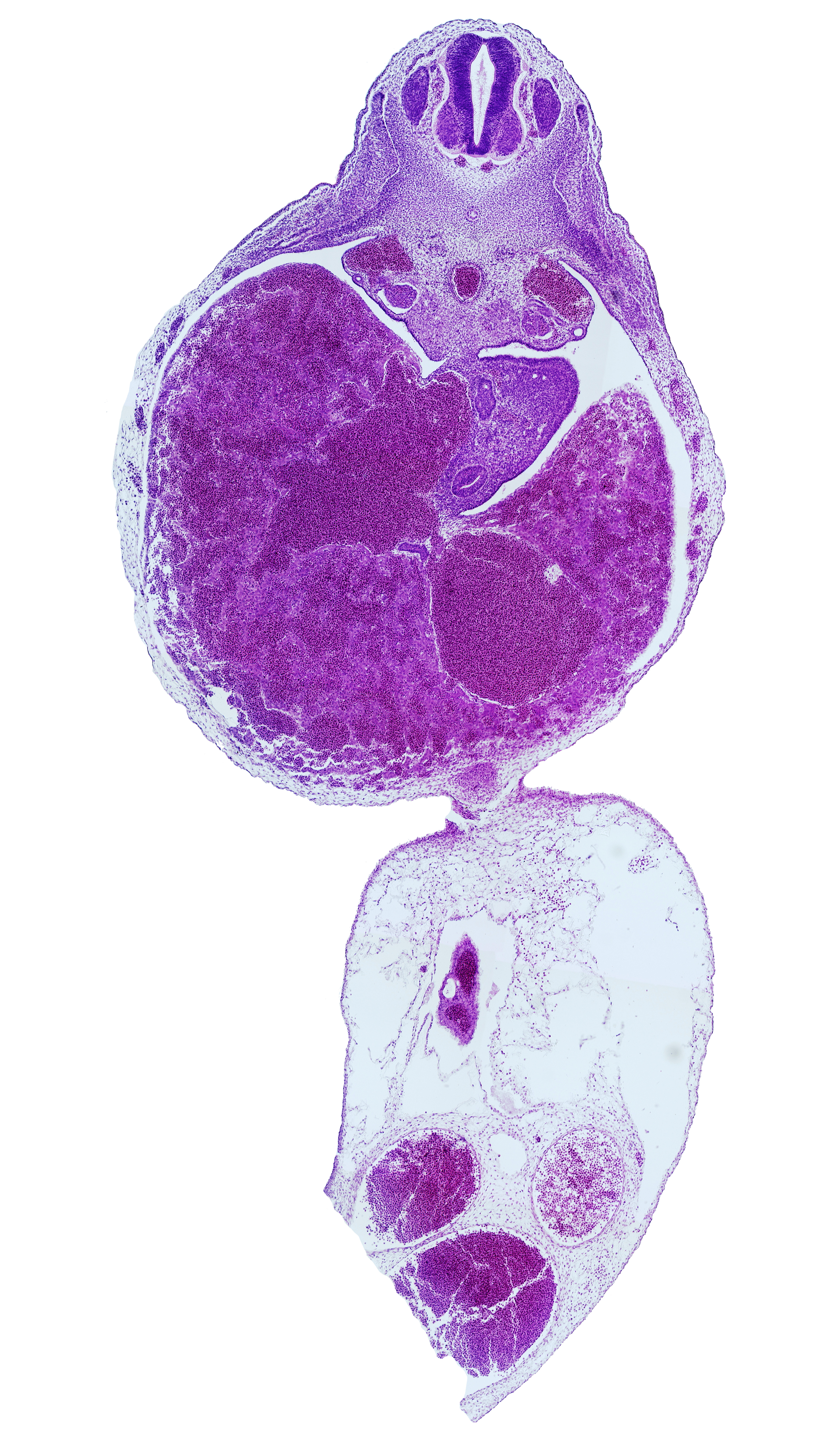 T-4 spinal ganglion, aorta, ductus venosus, duodenum, junction of umbilical cord and ventral body wall, left umbilical artery, liver, mesonephros, postcardinal vein, right umbilical artery, umbilical coelom, umbilical vein