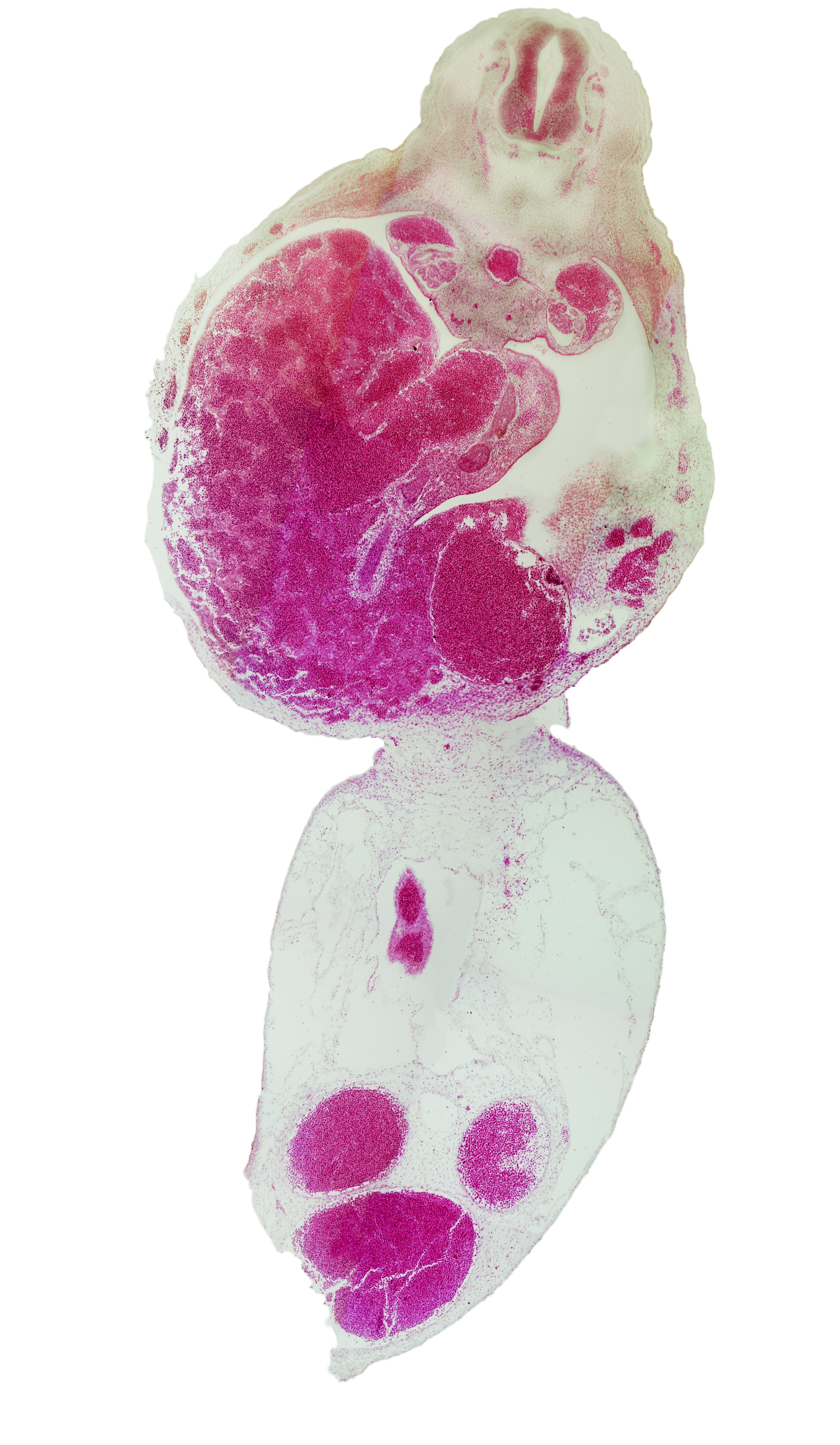 T-4 / T-5 interganglion region, aorta, bile duct, duodenum, junction of ductus venosus and left umbilical vein, left umbilical artery, liver, notochord, postcardinal vein, right umbilical artery, umbilical coelom, umbilical vein, vitelline (omphalomesenteric) artery, vitelline (omphalomesenteric) vein