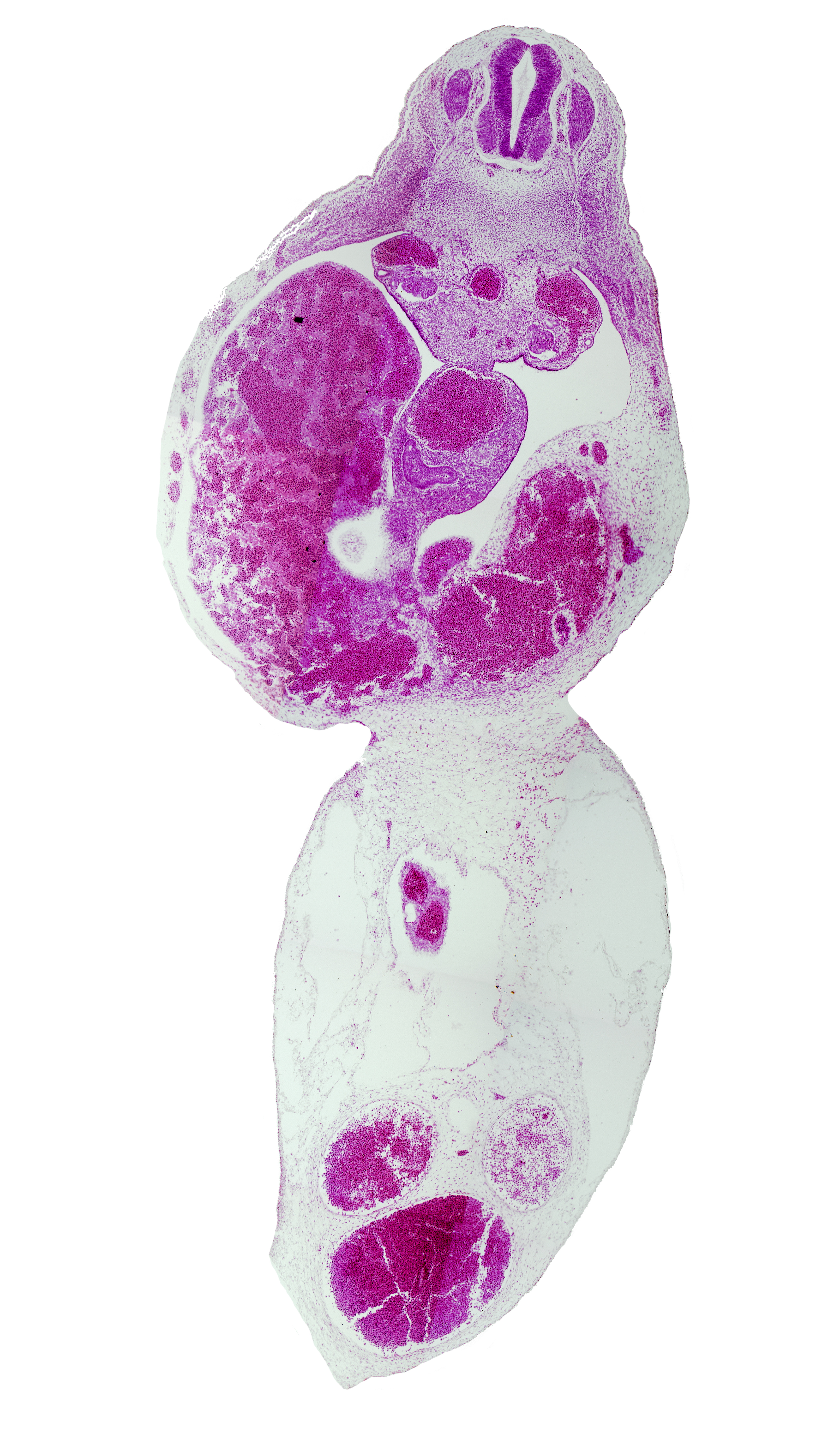 T-5 spinal ganglion, aorta, duodenum, junction of left umbilical vein and liver, junction of liver and right umbilical vein, left umbilical artery, liver, mesonephric duct, peritoneal cavity, umbilical coelom, umbilical vein, ventral pancreas, vitelline (omphalomesenteric) artery, vitelline (omphalomesenteric) vein