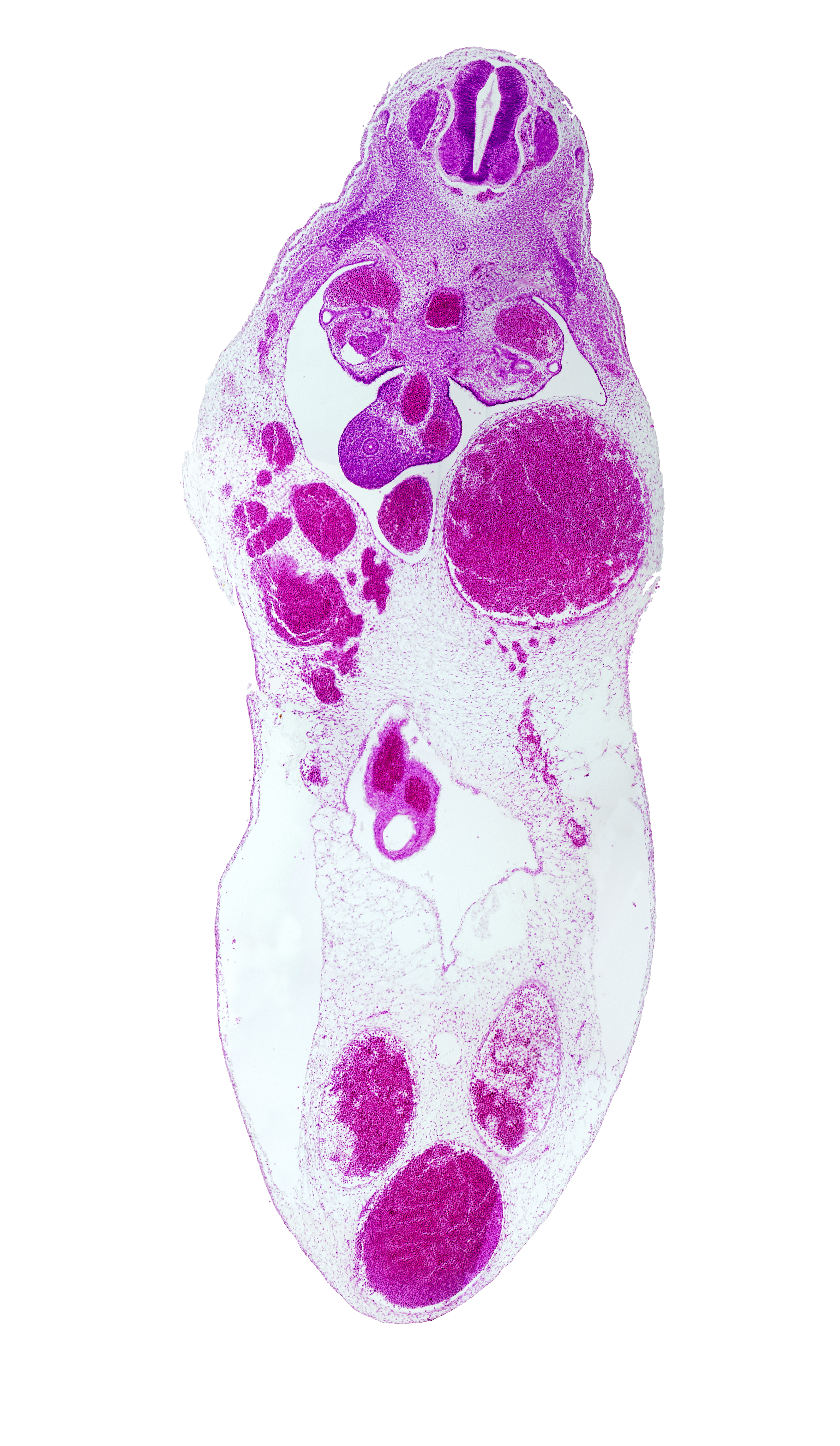 T-6 spinal ganglion, allantois, gonadal ridge, left umbilical artery, left umbilical vein (congested), mesonephric duct, midgut, rib primordium, right umbilical artery, right umbilical vein, superior mesenteric artery, umbilical coelom, umbilical vein, vitelline (omphalomesenteric) vein