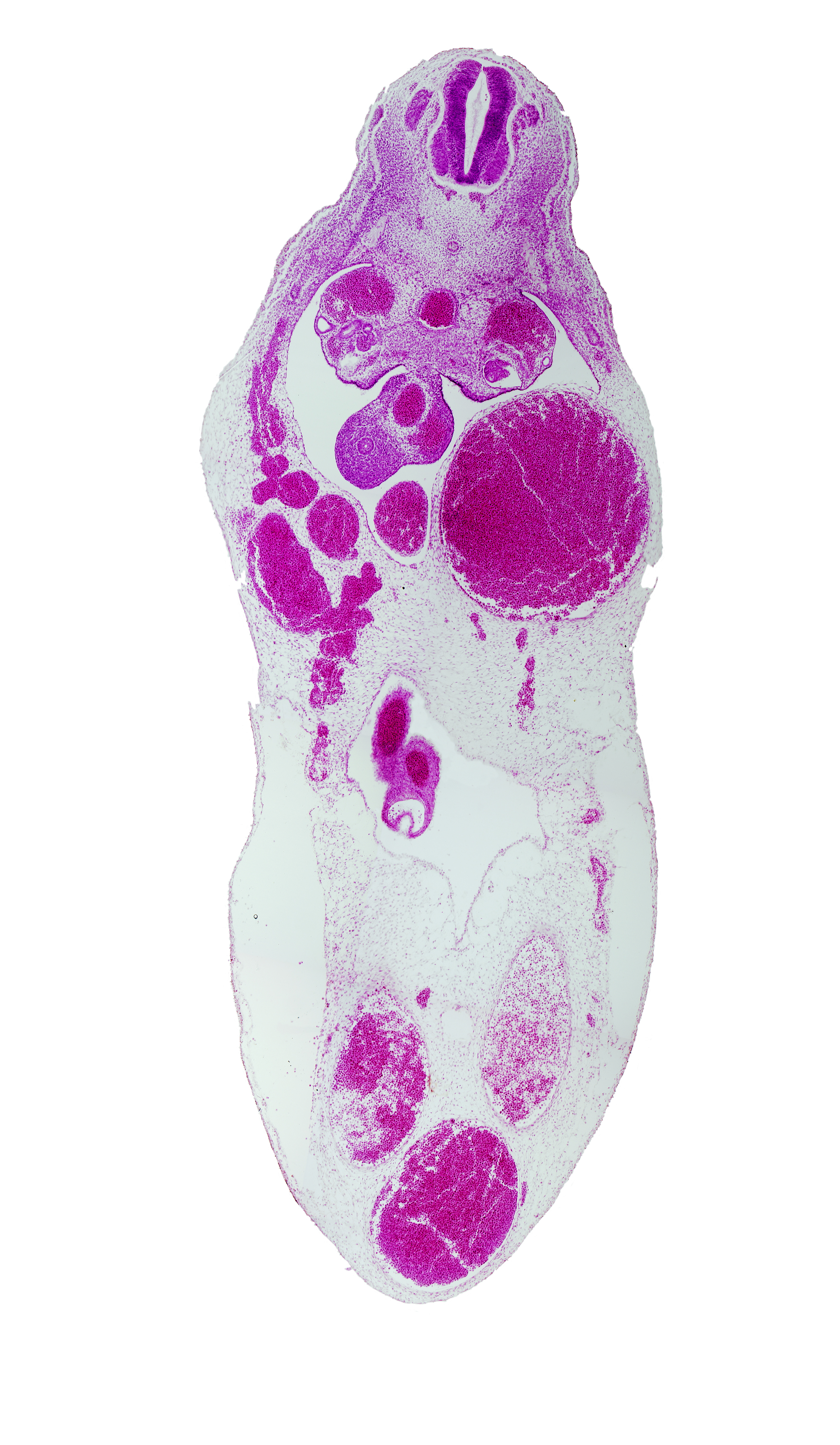 T-6 / T-7 interganglion region, allantois, aorta, gonadal ridge, left umbilical vein (congested), midgut, superior mesenteric artery, umbilical coelom, umbilical vesicle stalk remnant, vitelline (omphalomesenteric) artery, vitelline (omphalomesenteric) vein