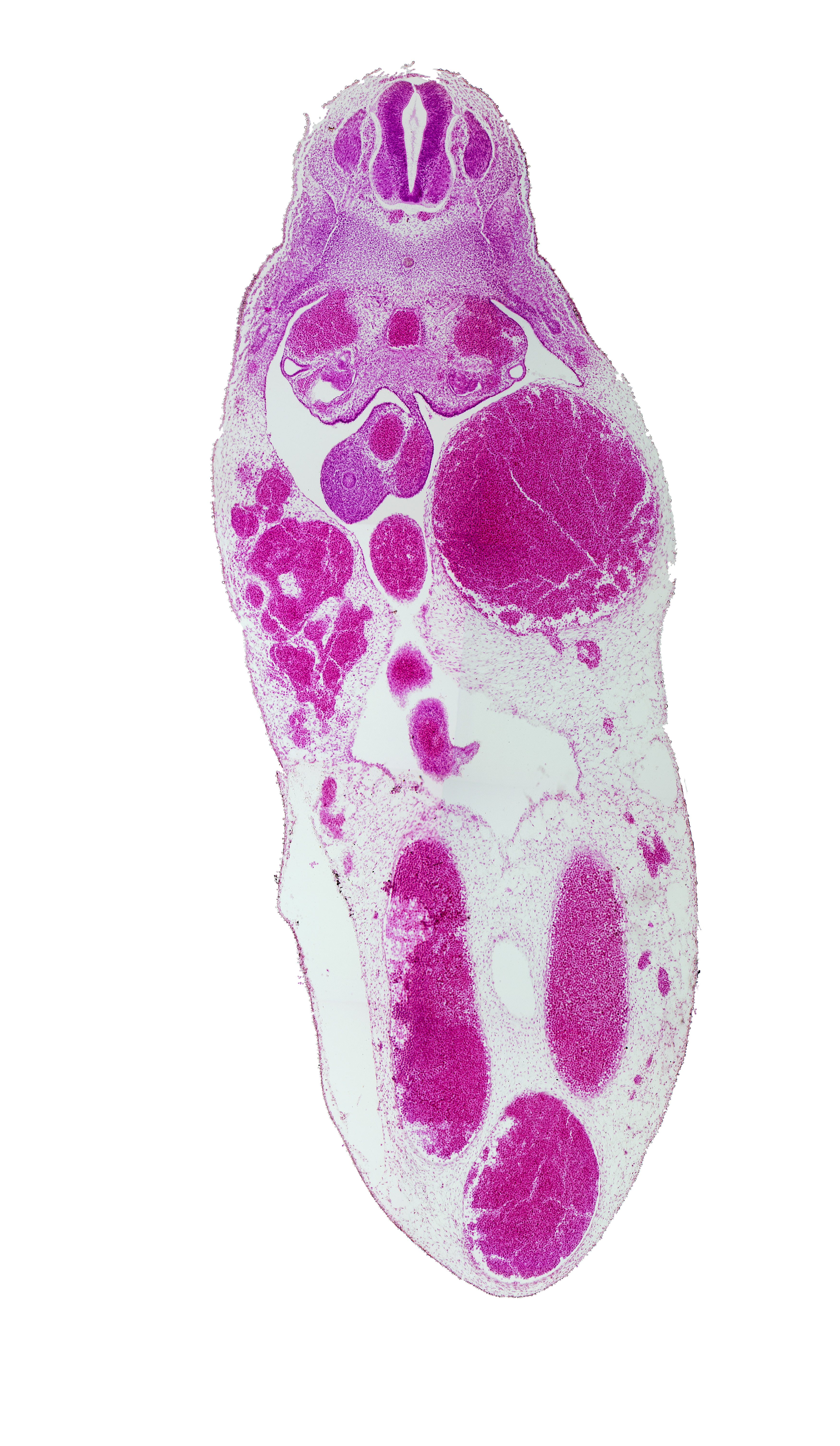 T-7 spinal ganglion, aorta, junction of peritoneal cavity and umbilical coelom, left umbilical artery, left umbilical vein, mesonephric duct, midgut, midgut umbilical intestinal loop, notochord, postcardinal vein, right umbilical artery, superior mesenteric artery, umbilical coelom, umbilical vein, vitelline (omphalomesenteric) vein