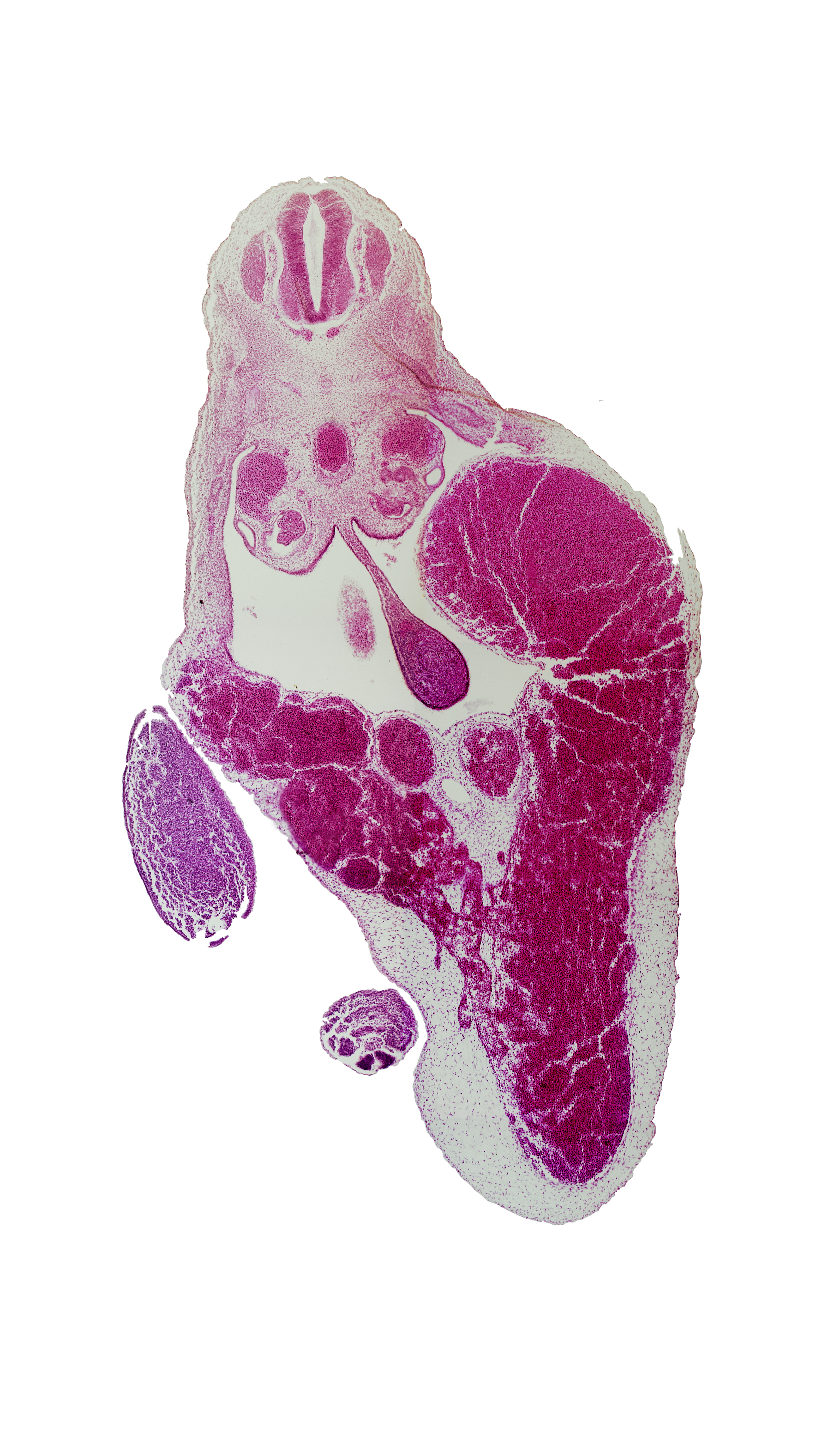 T-9 spinal ganglion, allantois, aorta, caudal edge of superior mesenteric artery, caudal eminence, dorsal mesentery, gonadal ridge, junction of definitive umbilical vein and right umbilical vein, lower limb (distal part), mesonephric duct, midgut, umbilical cord