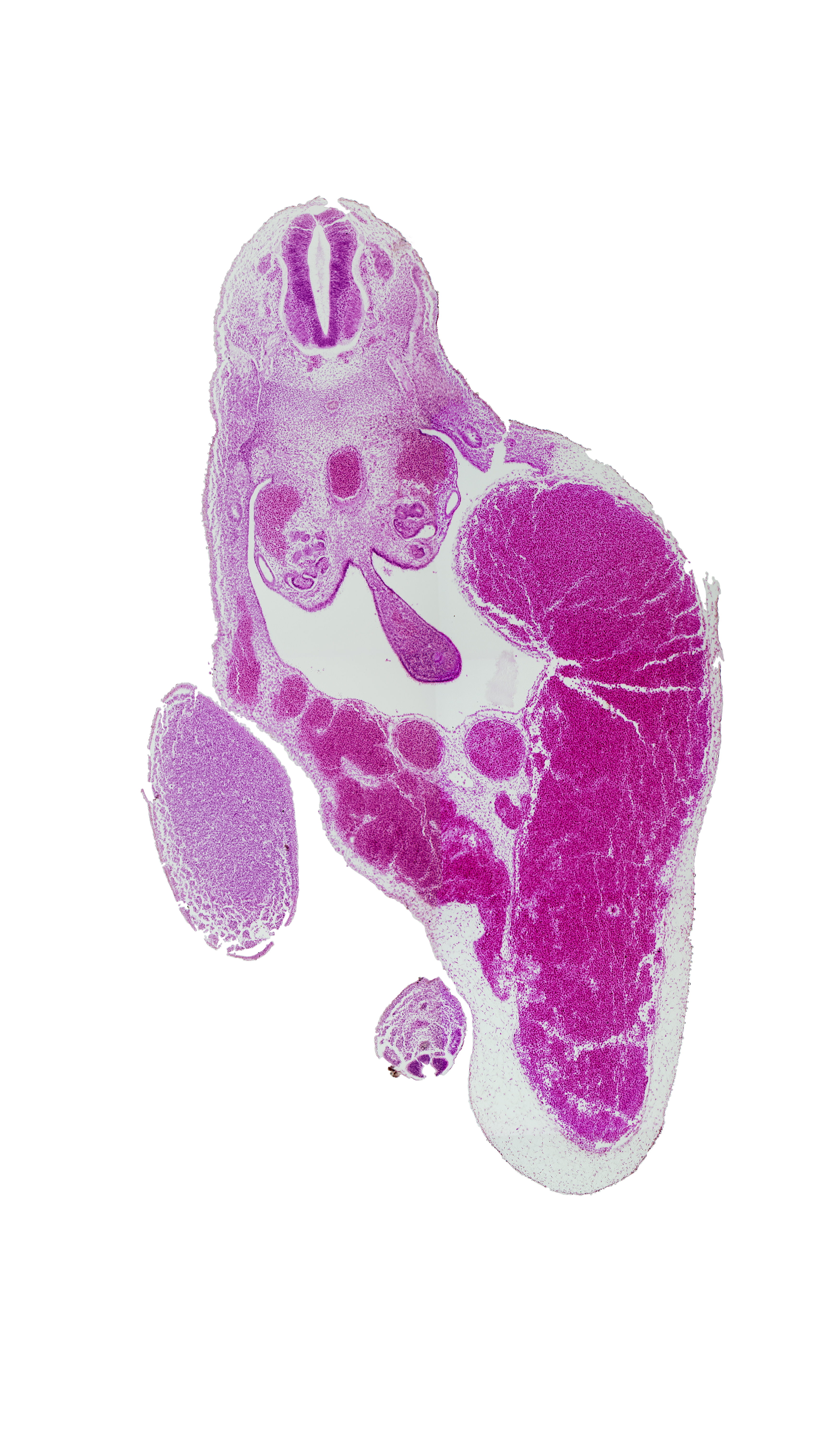 allantois, aorta, caudal edge of T-9 spinal ganglion, caudal eminence, central canal, dorsal mesentery, left umbilical vein, lower limb (proximal part), mesonephric duct, midgut endoderm, peritoneal cavity, spinal cord, umbilical cord, umbilical vein