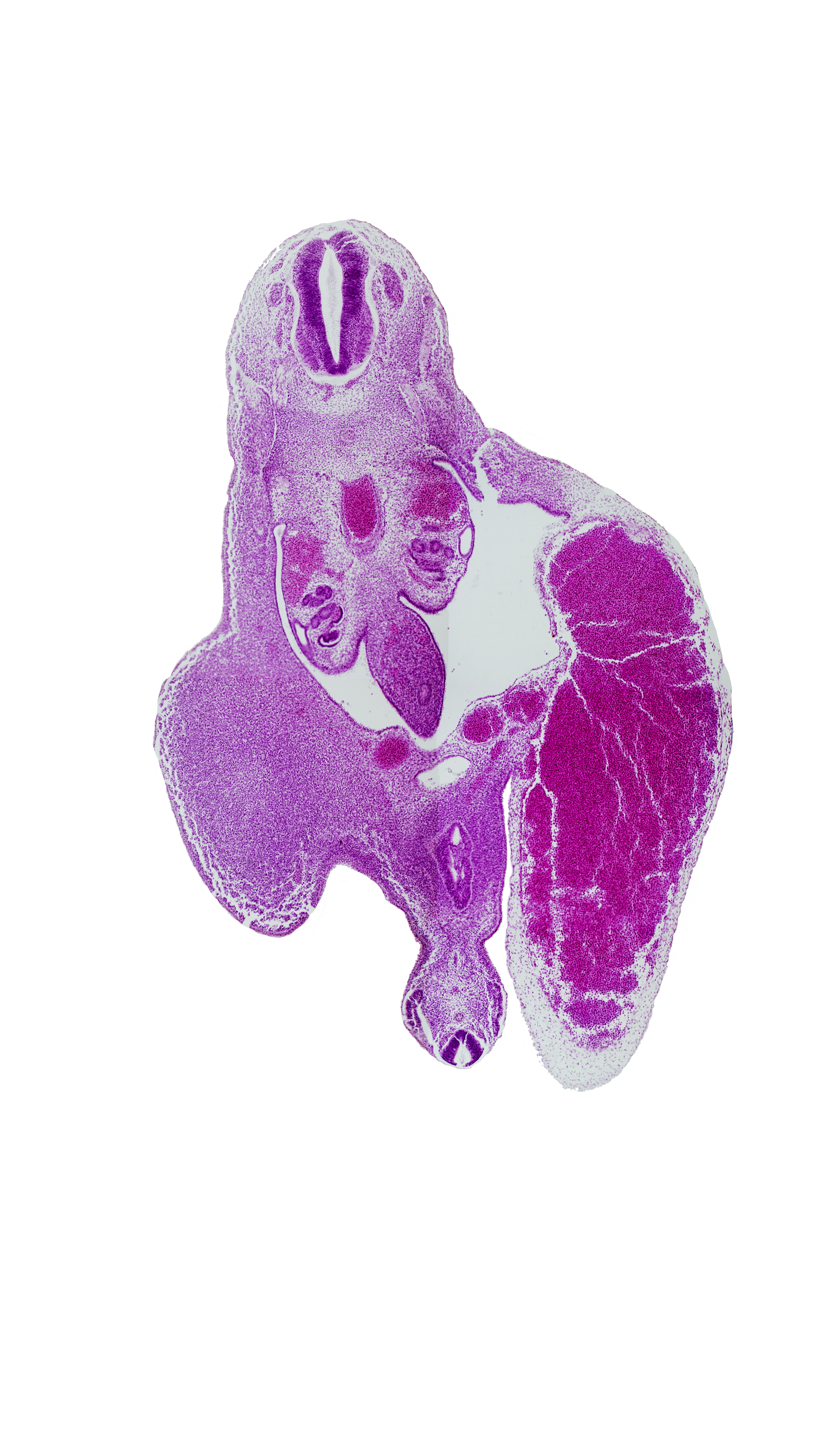 T-10 spinal ganglion, aorta, caudal part of primordial urogenital sinus, caudal part of tailgut, gonadal ridge, hindgut, left umbilical vein, lower limb (proximal part), mesonephric duct, mesonephros, primordial urogenital sinus