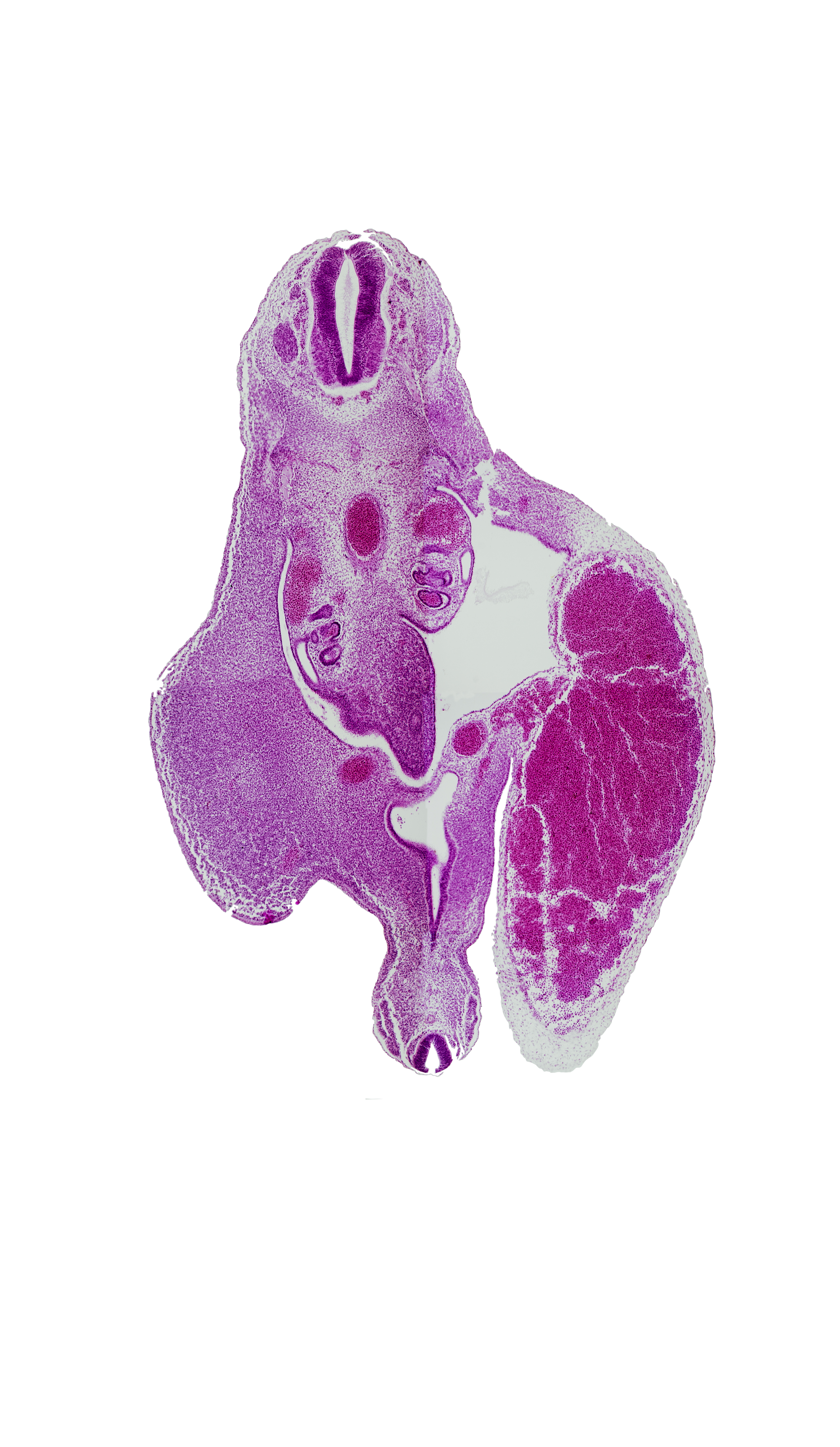 T-10 / T-11 interganglion region, aorta, artifact separation(s), central canal, dermatomyotome, junction of hindgut and primordial urogenital sinus, junction of mesonephric duct and urogenital sinus, left umbilical artery, mesonephric duct, mesonephric vesicle(s), notochord, peritoneal cavity, primordial urogenital sinus, right umbilical artery, roof plate, tail gut