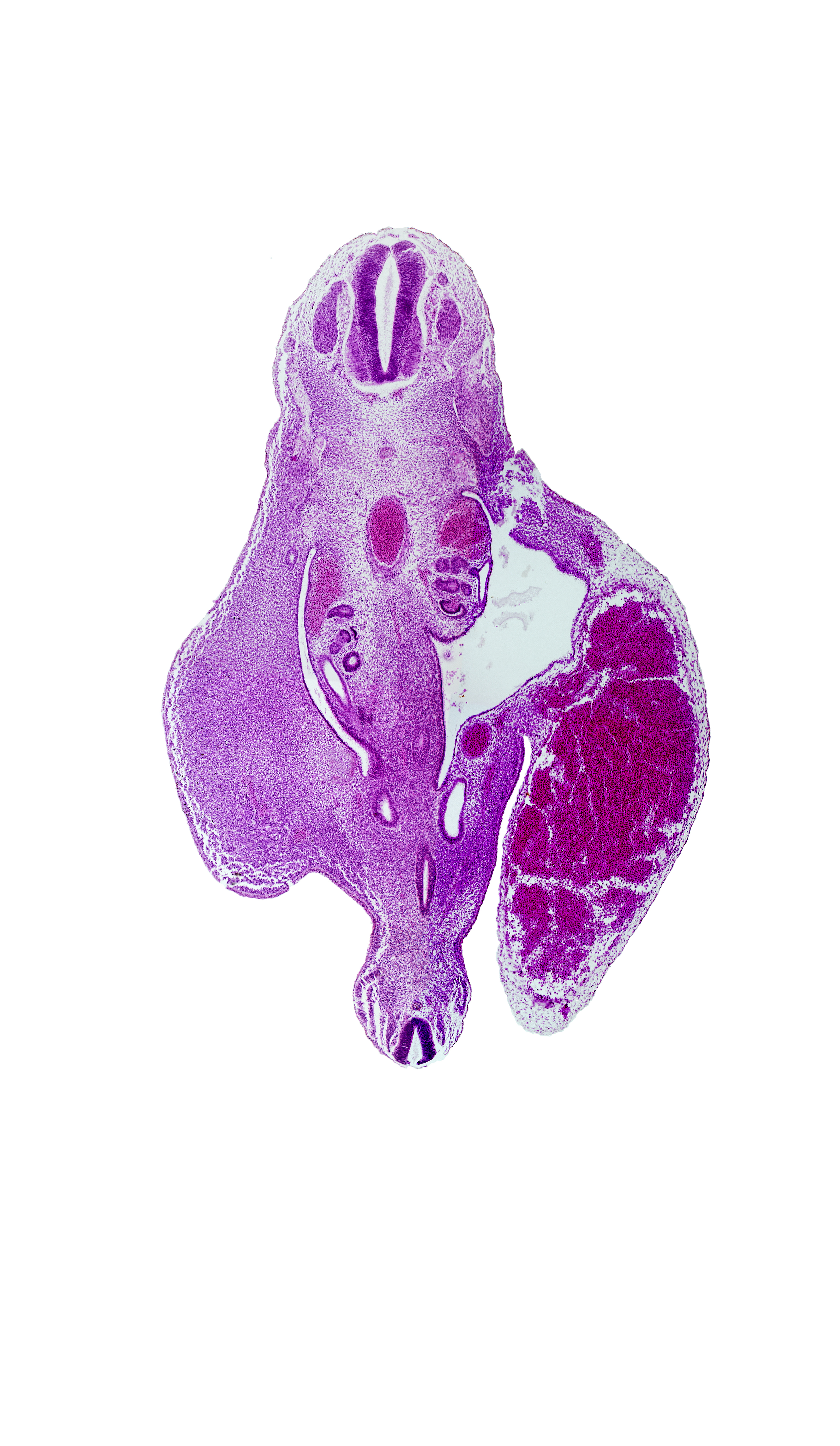 Co-1 spinal ganglion, T-11 spinal ganglion, aorta, dermatomyotome, hindgut, junction of mesonephric duct and metanephric diverticulum, left umbilical artery, mesonephric duct, notochord