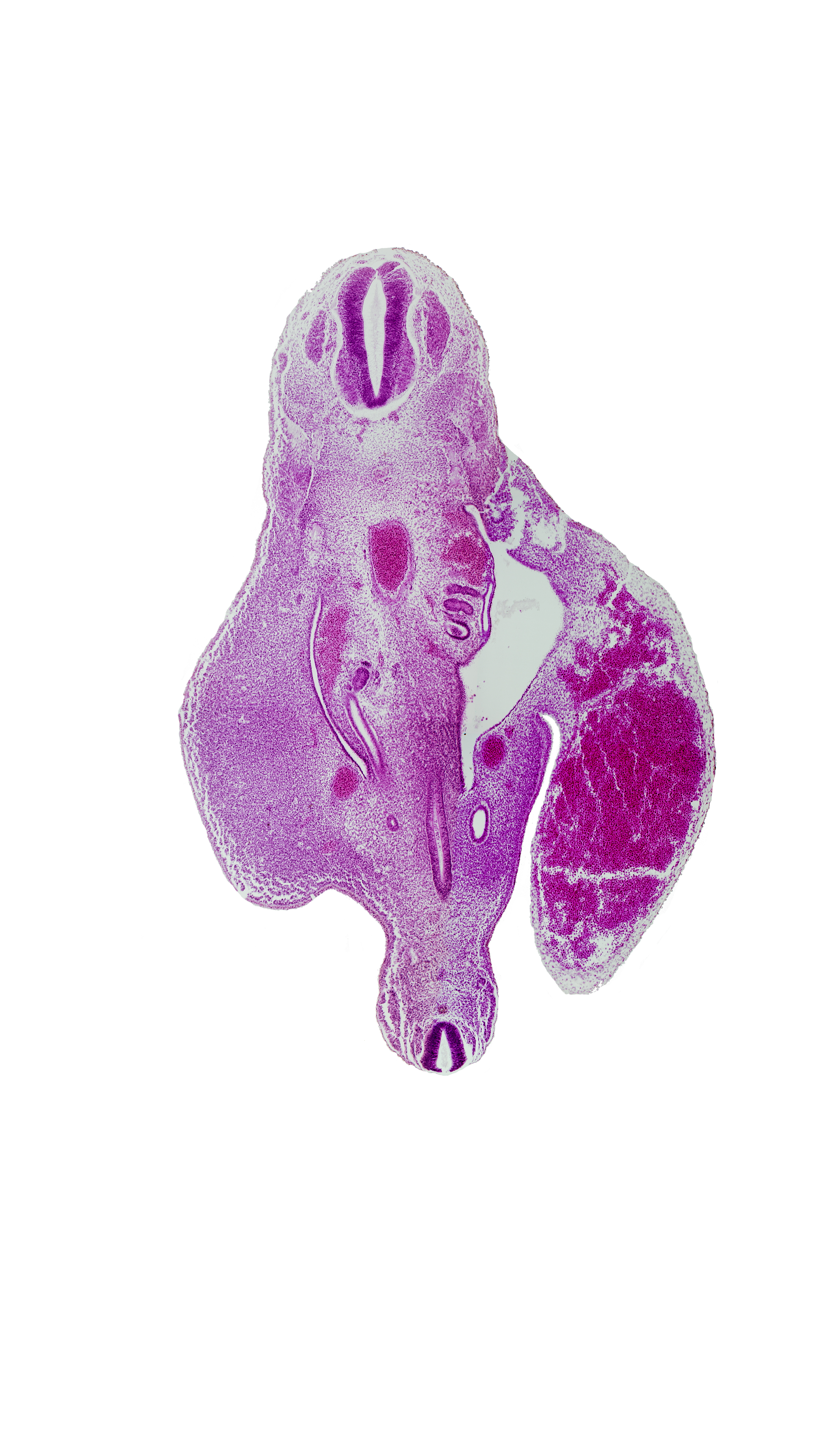 S-5 spinal ganglion, T-11 spinal ganglion, aorta, caudal edge of hindgut, caudal edge of mesonephric duct, caudal edge of peritoneal cavity, left umbilical vein (congested), mesonephric duct, metanephric diverticulum, peritoneal cavity, spinal cord