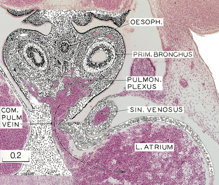 Mesenchymal tissue in the pulmonary and esophageal regions - Overlay