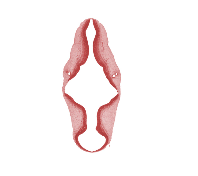 alar plate(s), artifact separation(s), basal plate, cephalic edge of accessory nerve (CN XI), head mesenchyme, isthmus of rhombencephalon, mesencoel (cerebral aqueduct), otic capsule, primordial meninx, rhombencoel (fourth ventricle), roof plate, surface ectoderm, tegmentum